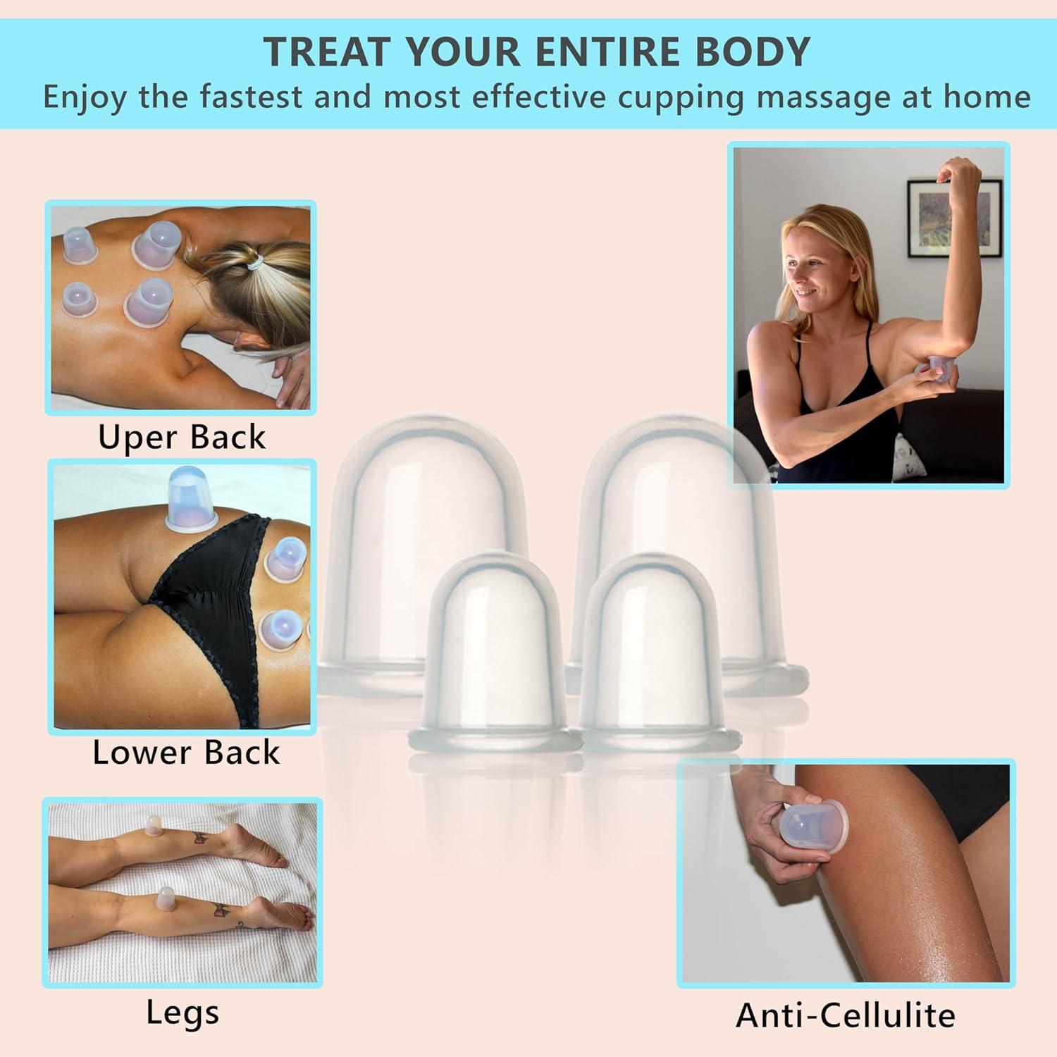 Kit de Ventosas de Silicona DoSensePro - 4 Piezas para Masaje