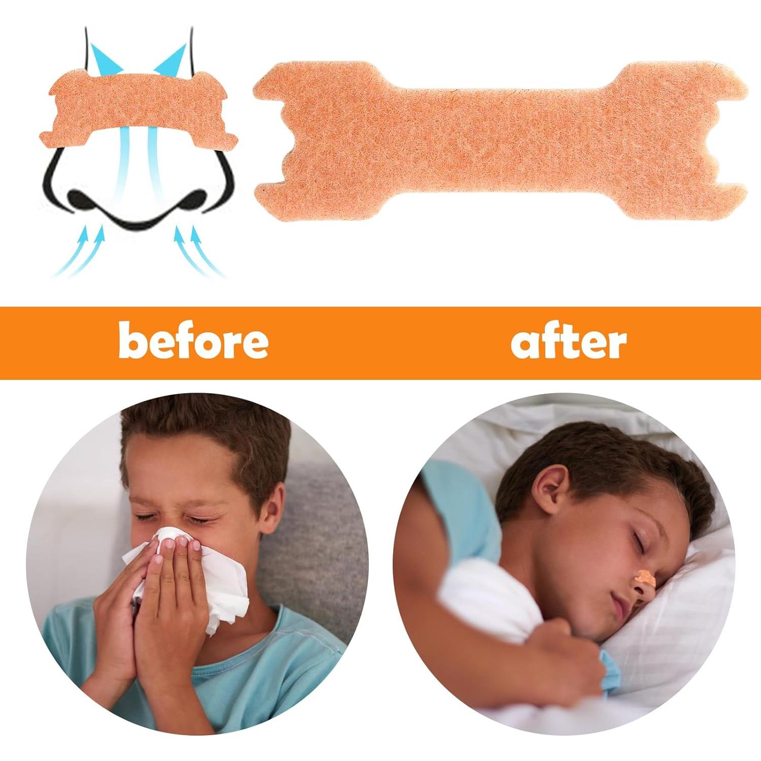 30 Tiras Nasales para Niños CMINAUS - Alivio Congestión