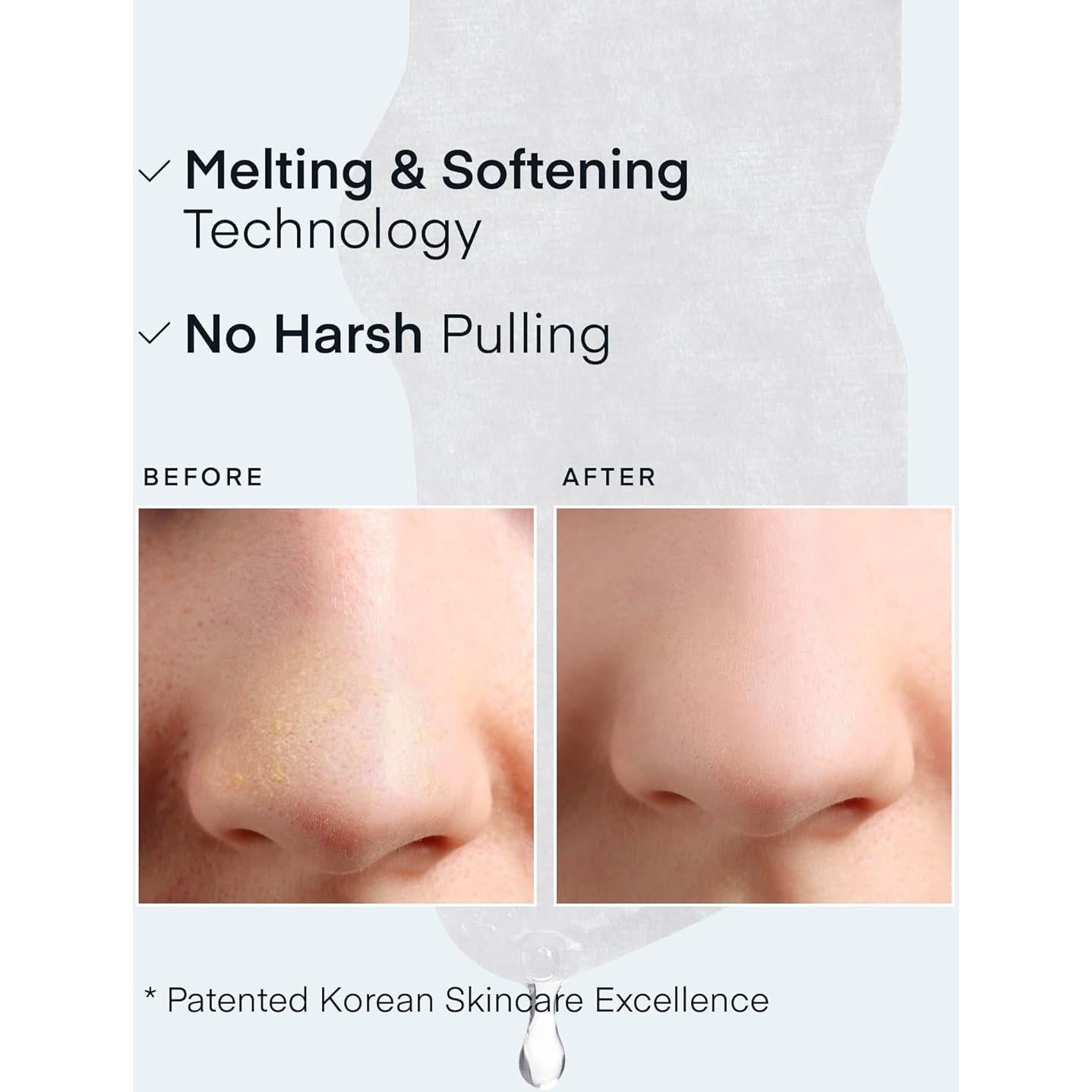 Tiras Eliminadoras de Puntos Negros Dewycream - 5 Kits