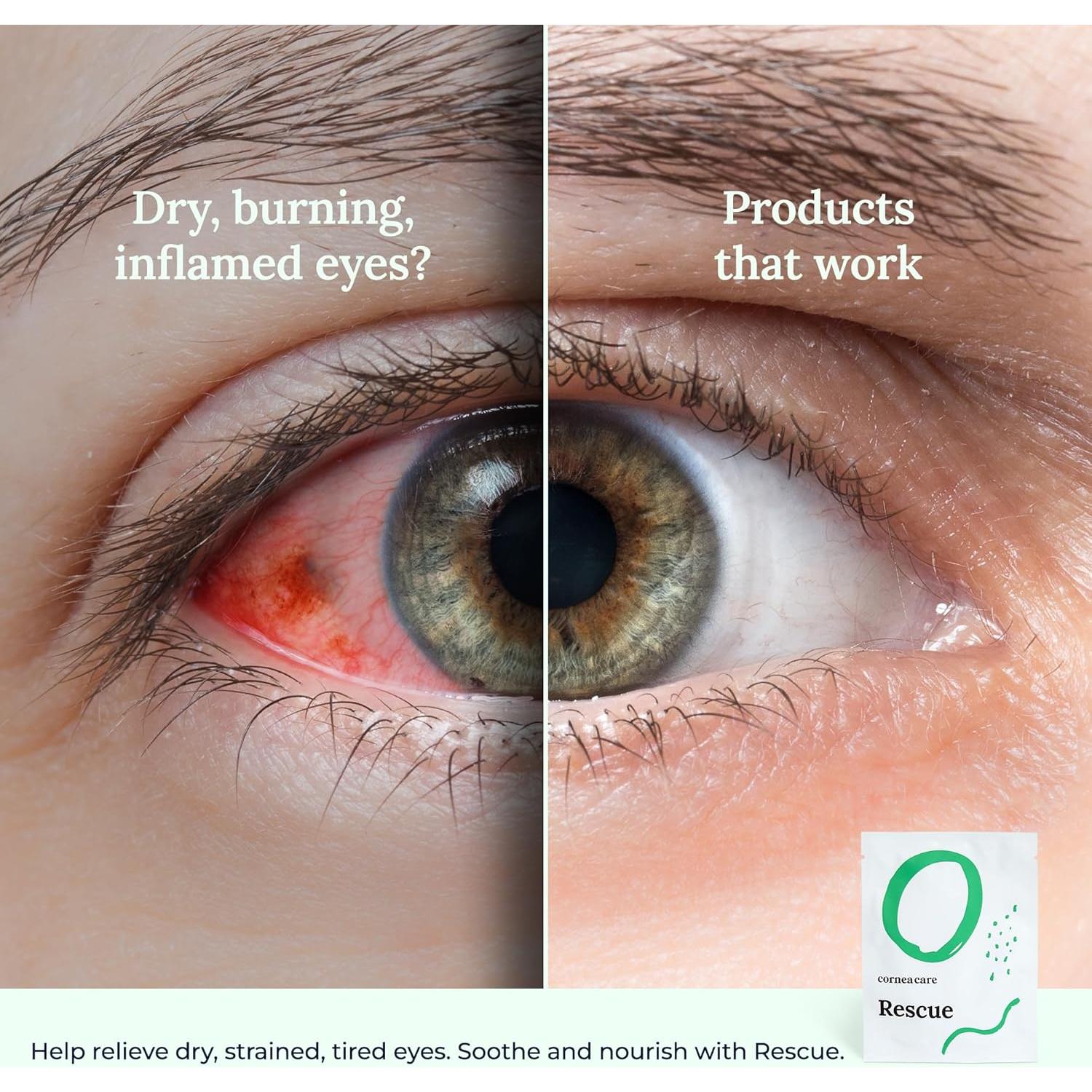 Compresas Frías para Ojos Rescate - 6 Unidades Hidrogel