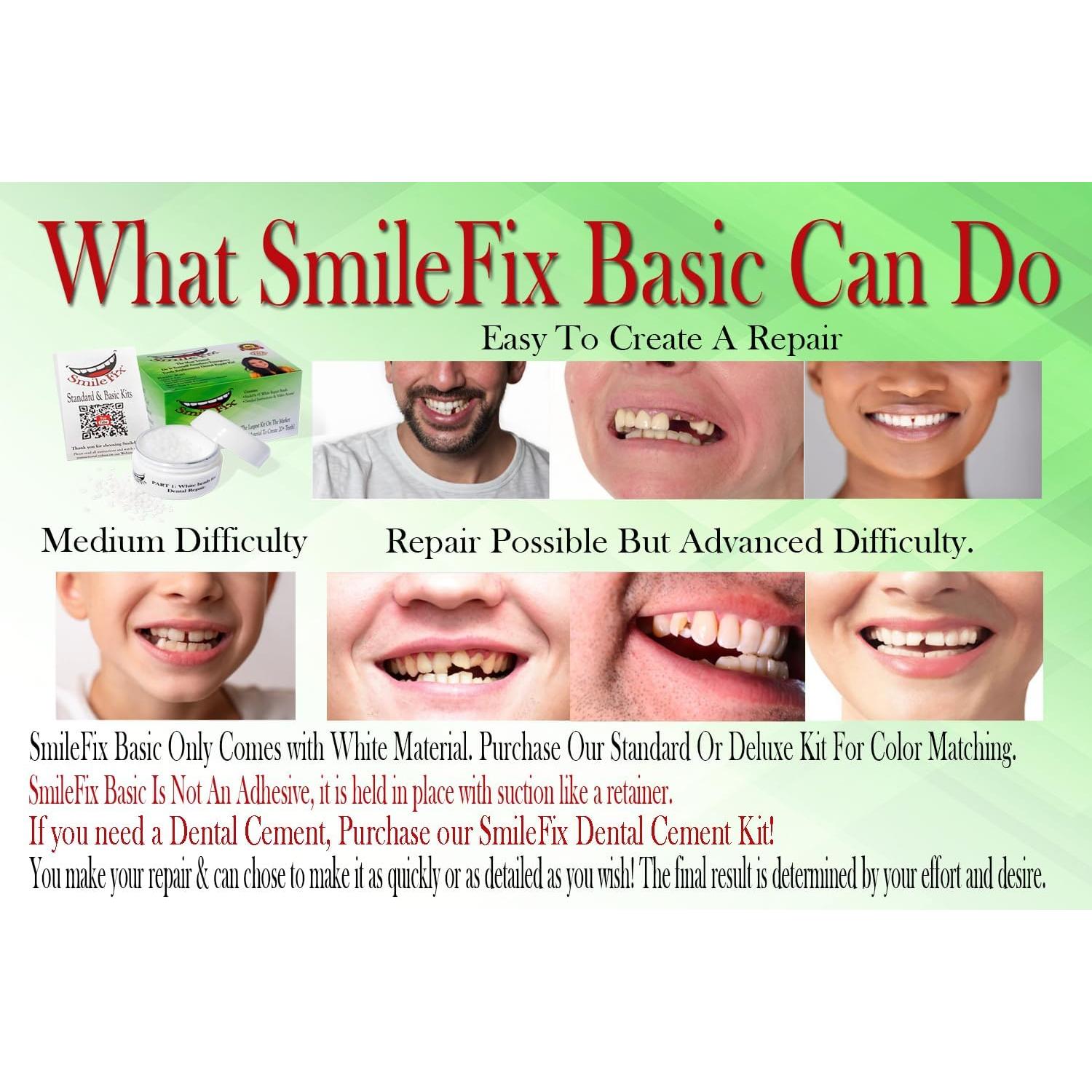 SmileFix Reparación Dental Básica - Dientes Faltantes y Rotos