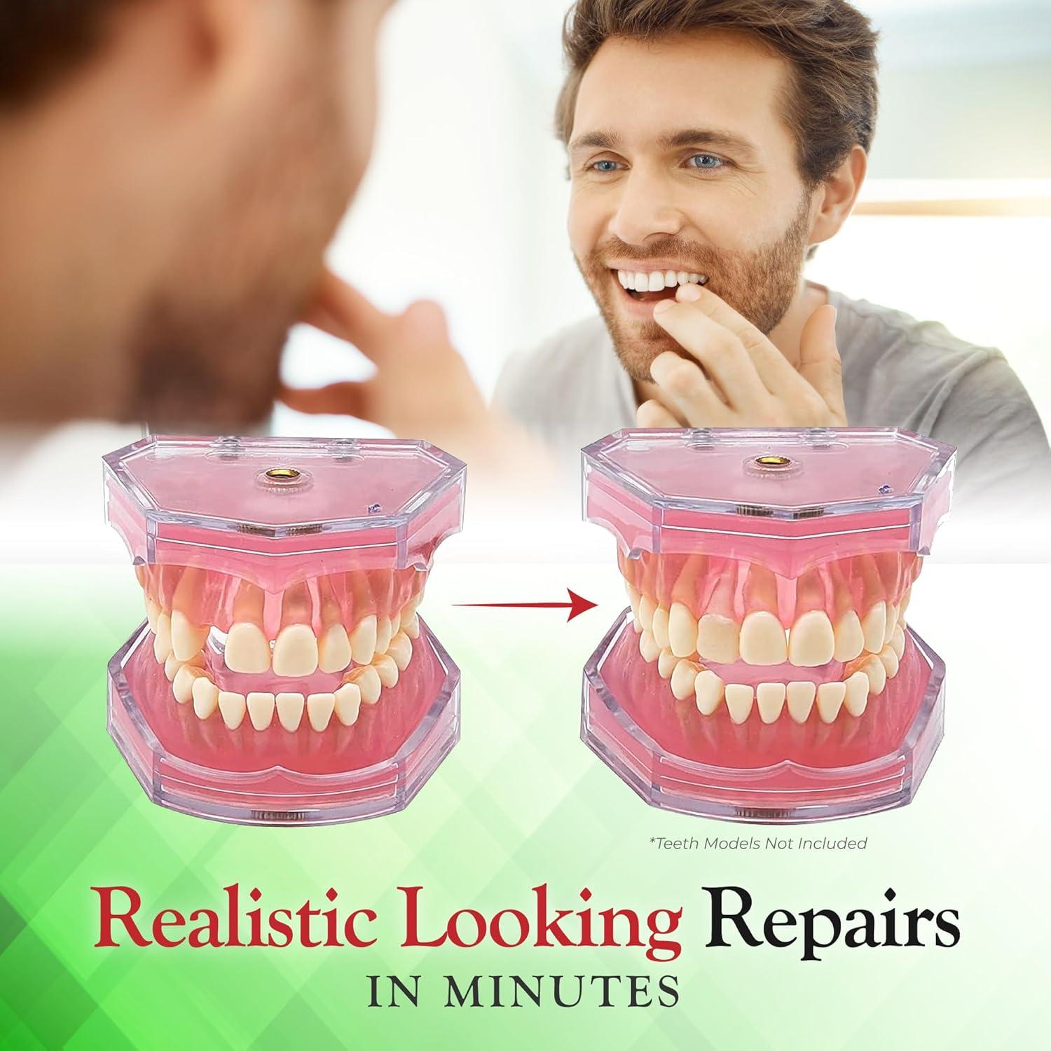 SmileFix Reparación Dental Básica - Dientes Faltantes y Rotos