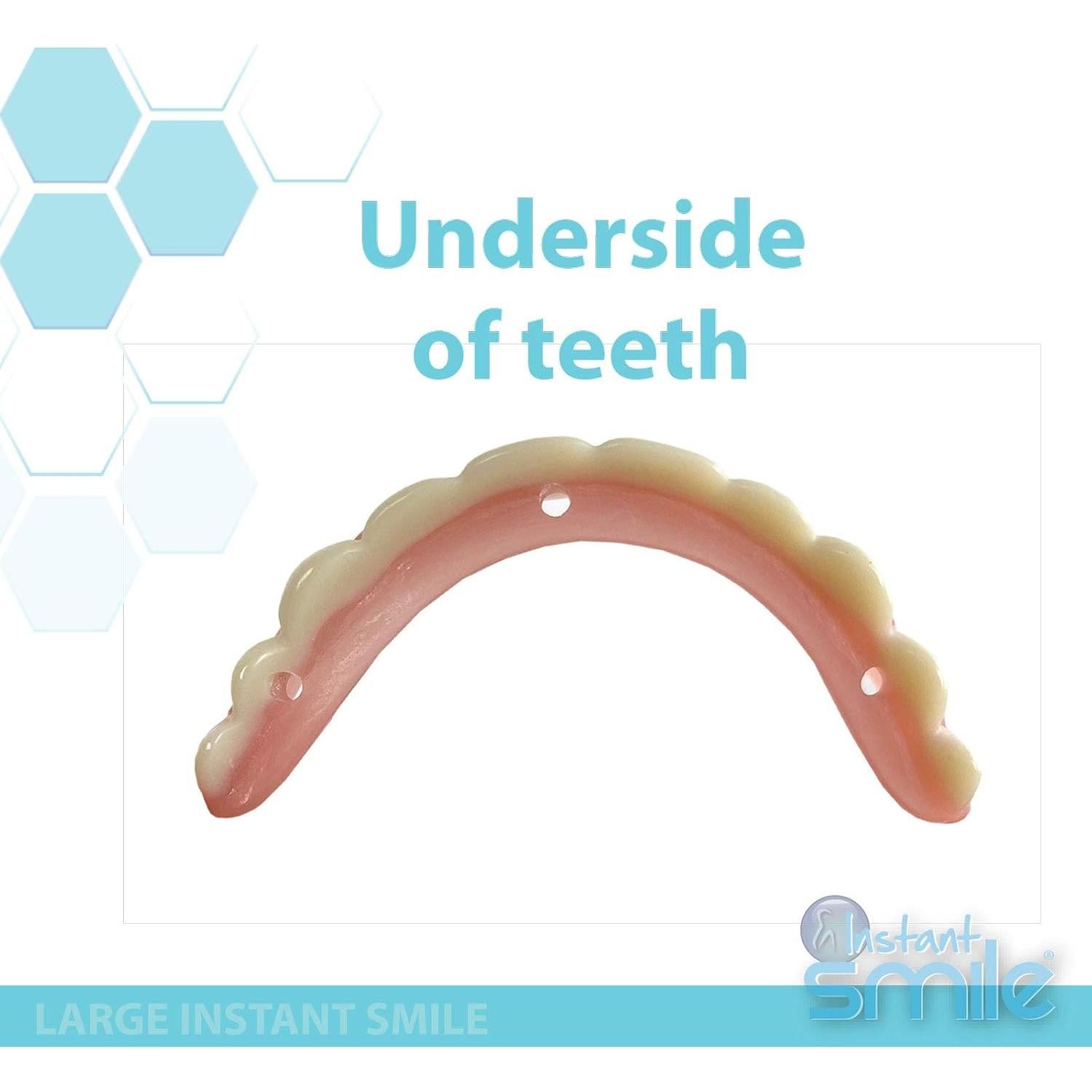 Carcasa Sonrisa Instantánea - Grande - Hecha a Mano - Repara Sonrisa