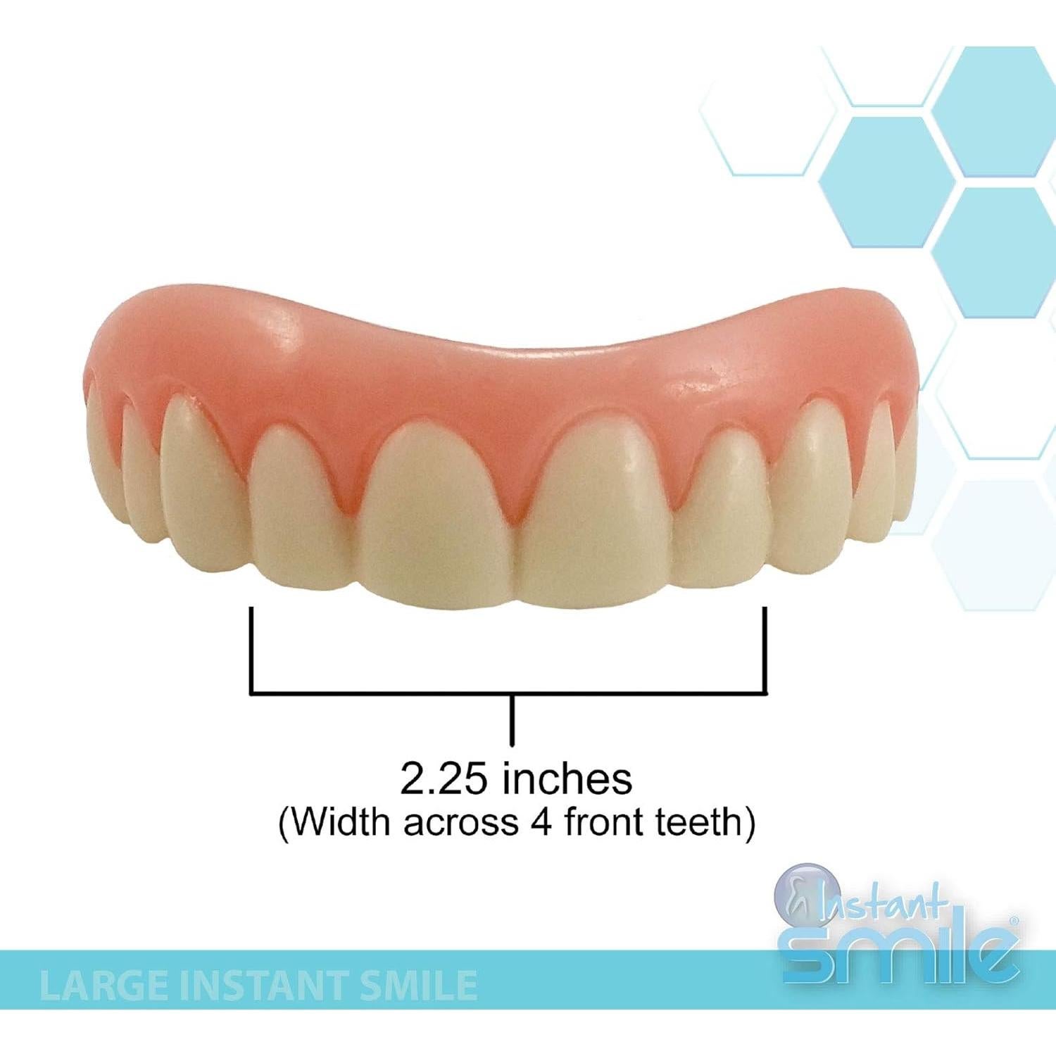 Carcasa Sonrisa Instantánea - Grande - Hecha a Mano - Repara Sonrisa