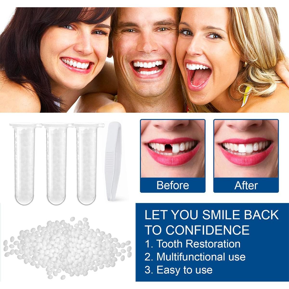 Kit de Reparación Dental Ceonam - Perlas Moldables 7,9x6x1,8cm