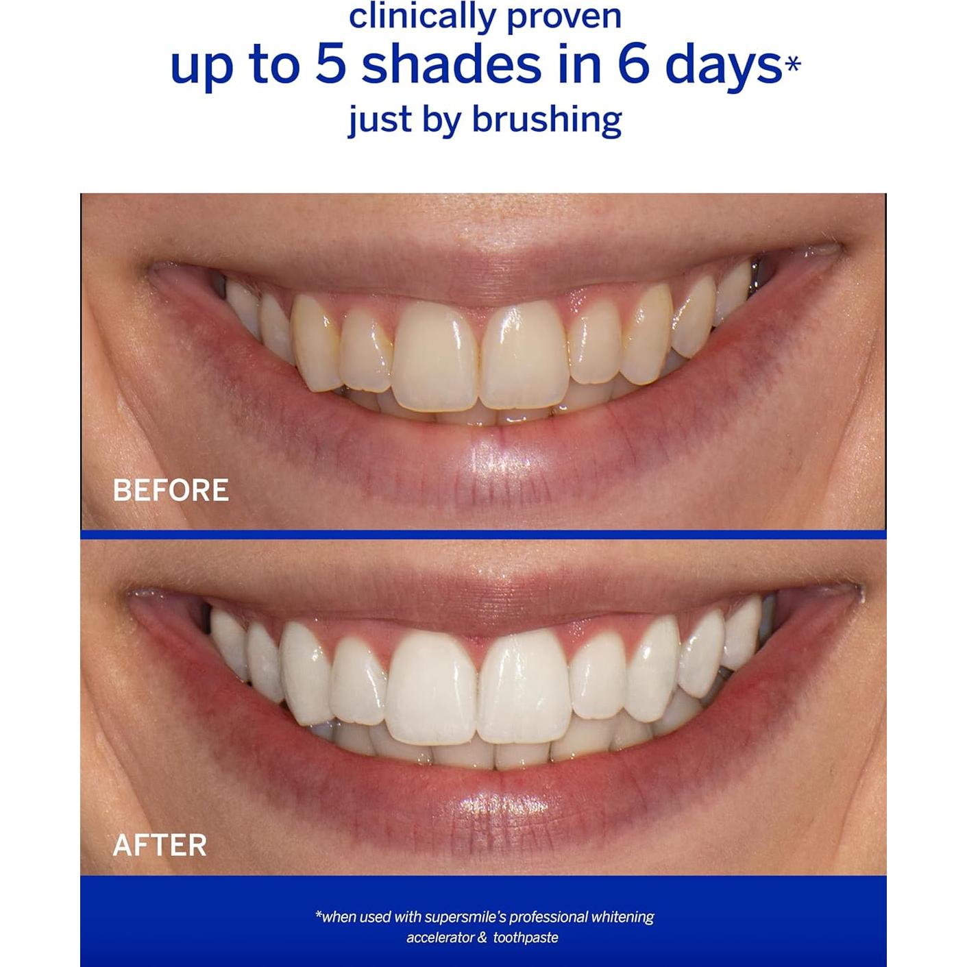 Acelerador Blanqueamiento Profesional Supersmile 136 g