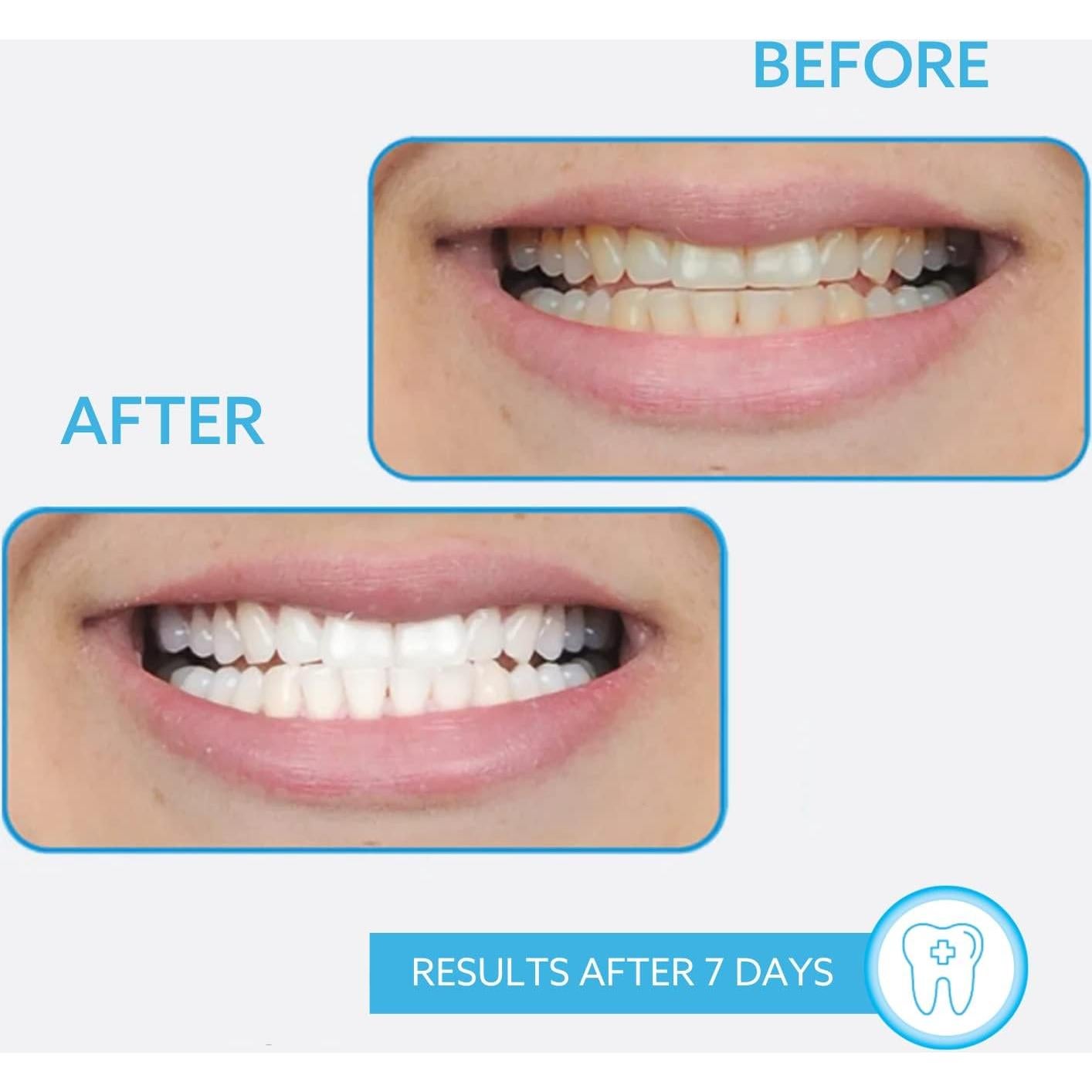 Bolígrafo Blanqueador GO SMILE 1.3mL para Dientes Blancos