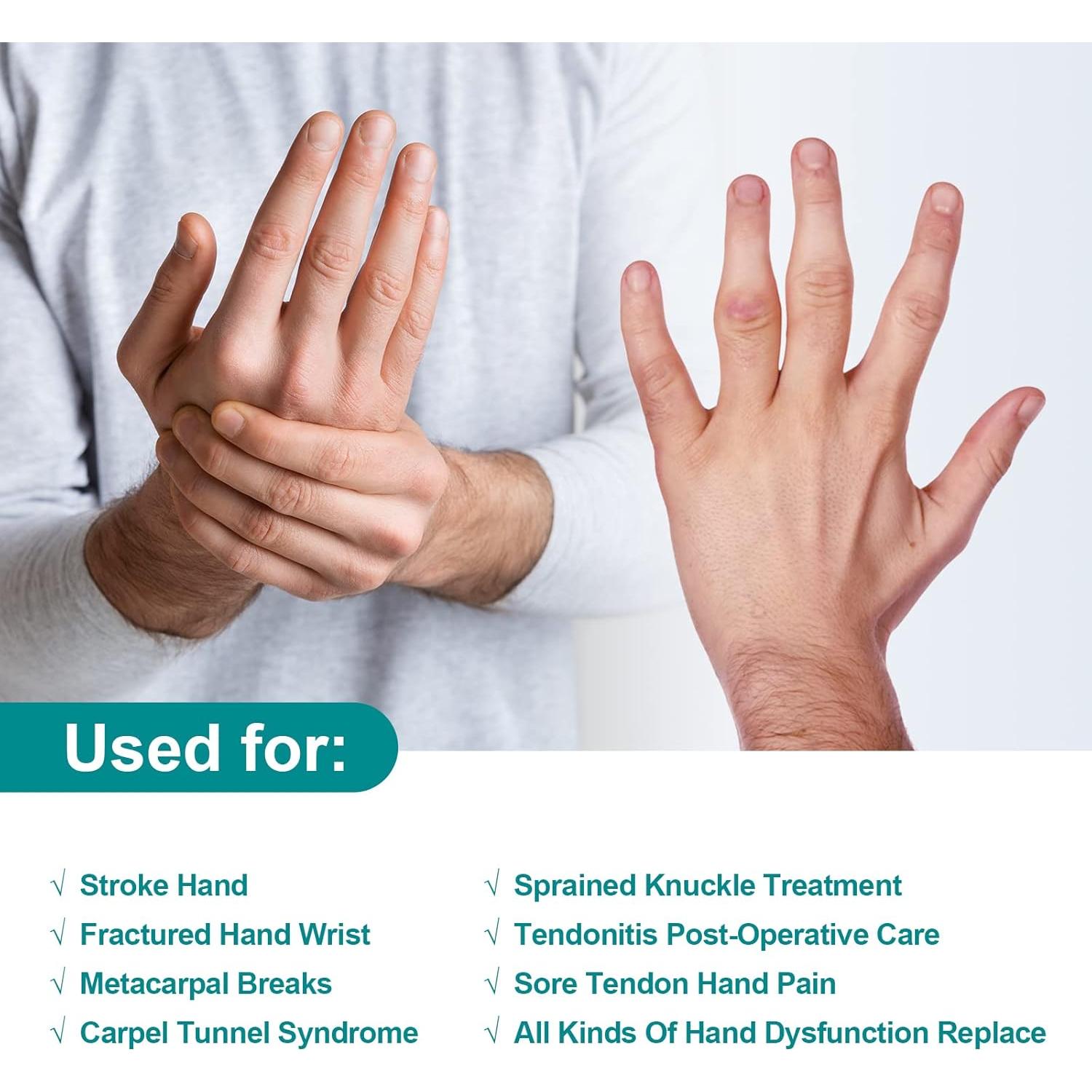 Férula de Mano en Reposo Sylong para Síndrome del Túnel Carpiano