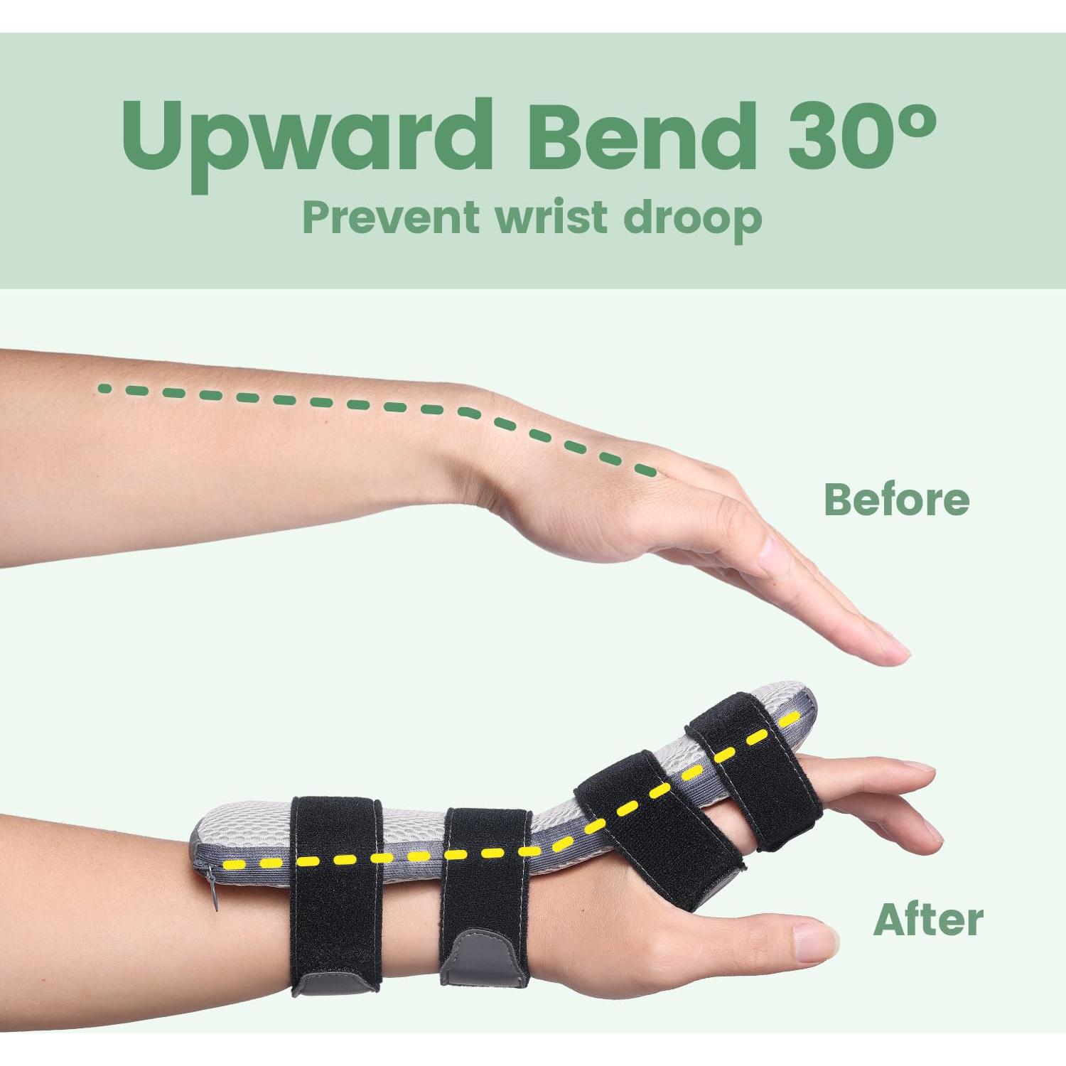 Férula Ajustable para Parálisis del Nervio Radial DrFinger