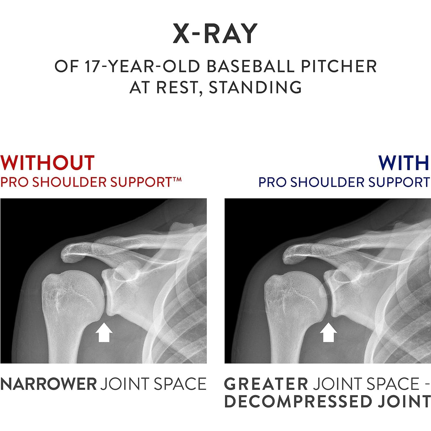 Soporte para Hombro OPTP PRO - Almohada Estándar para Dolor
