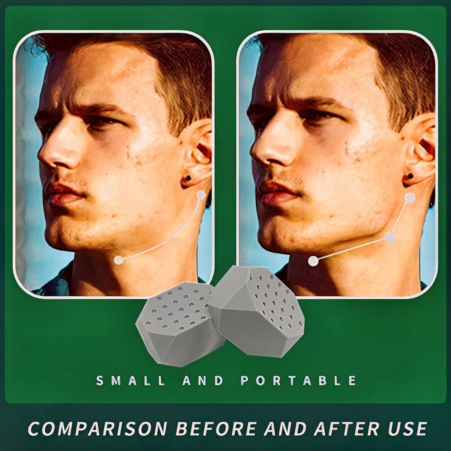 Ejercitador de Mandíbula U'Real - Reductor Facial Silicona BPA