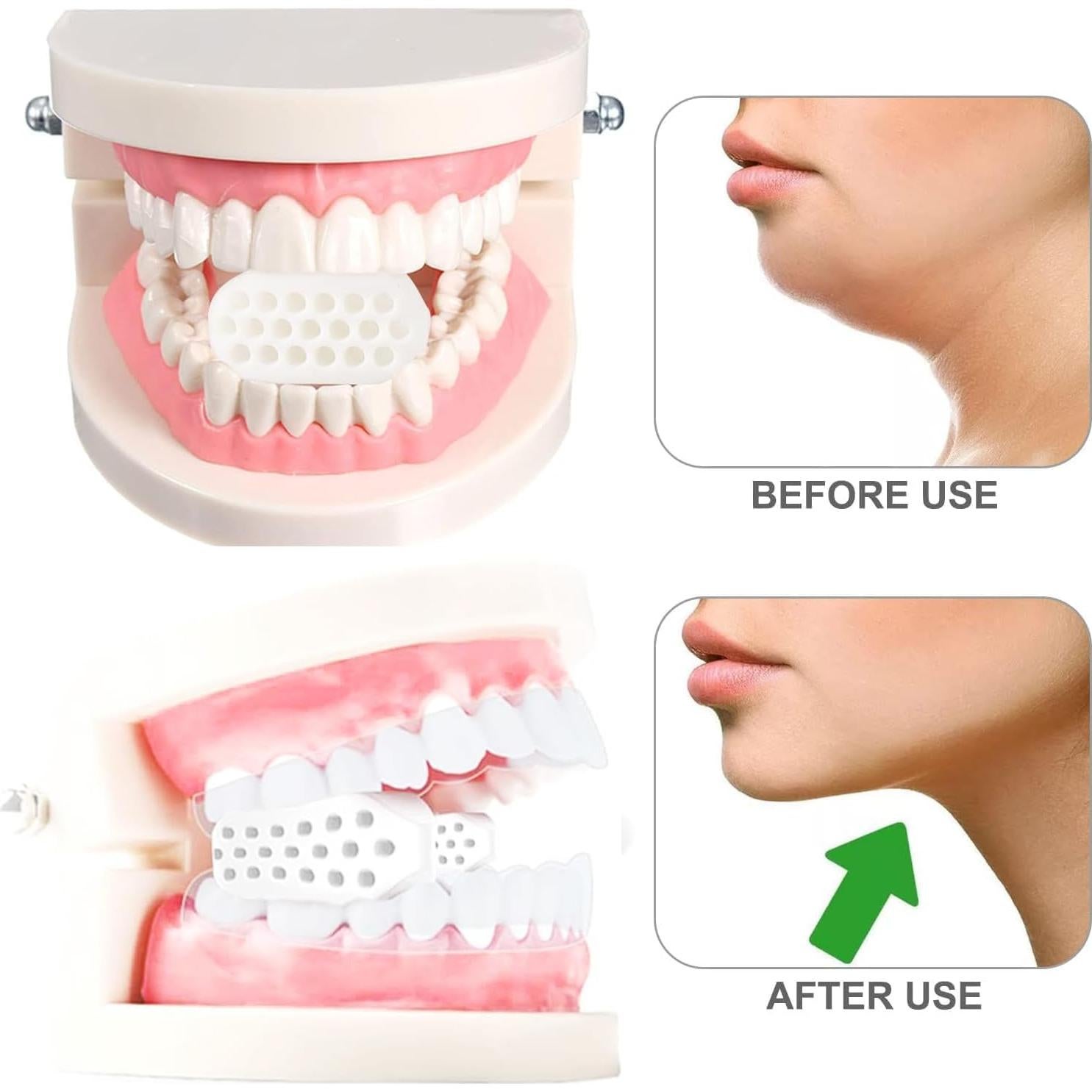 Ejercitador de Mandíbula Jowxsx - Silicona BPA, Resistencia
