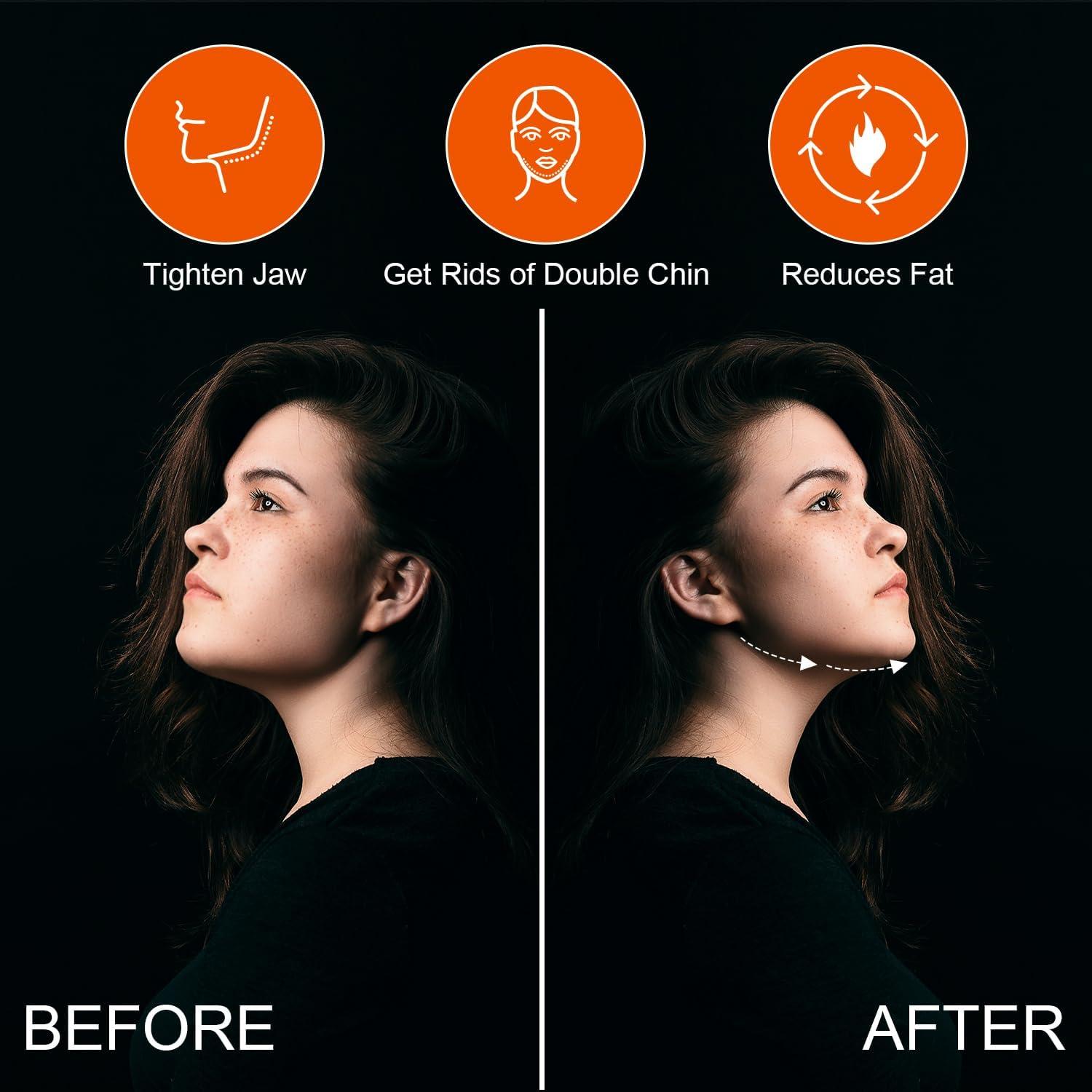 6pcs Silicone Jaw Exerciser, 3 Resistance Levels Jaw Trainer for Men & Women Jaw Trainer Face Shaper for Beginners Intermediate & Advanced Users (3 Colors)