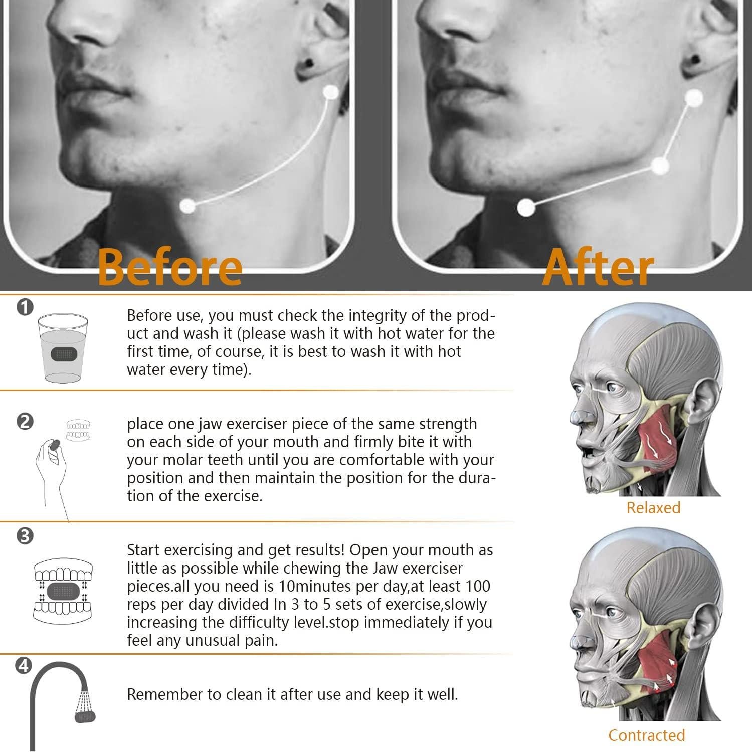 Ejercitador de Mandíbula COOLCHUMP 6 Piezas 3 Niveles Resistencia