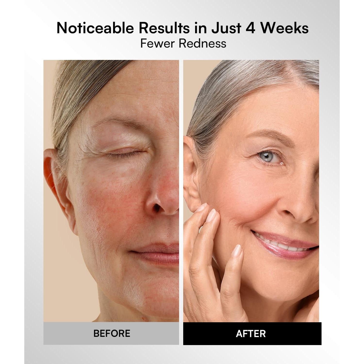 Máscara de Terapia de Luz Roja INIA - 4 Modos, 220 Chips LED