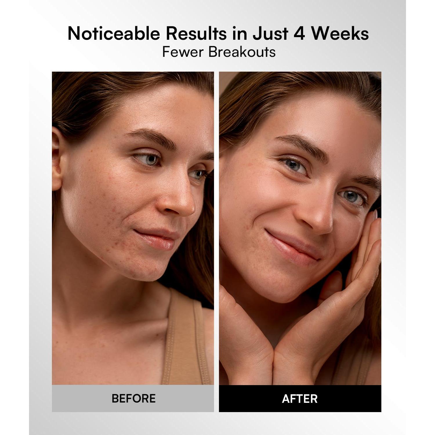 Máscara de Terapia de Luz Roja INIA - 4 Modos, 220 Chips LED