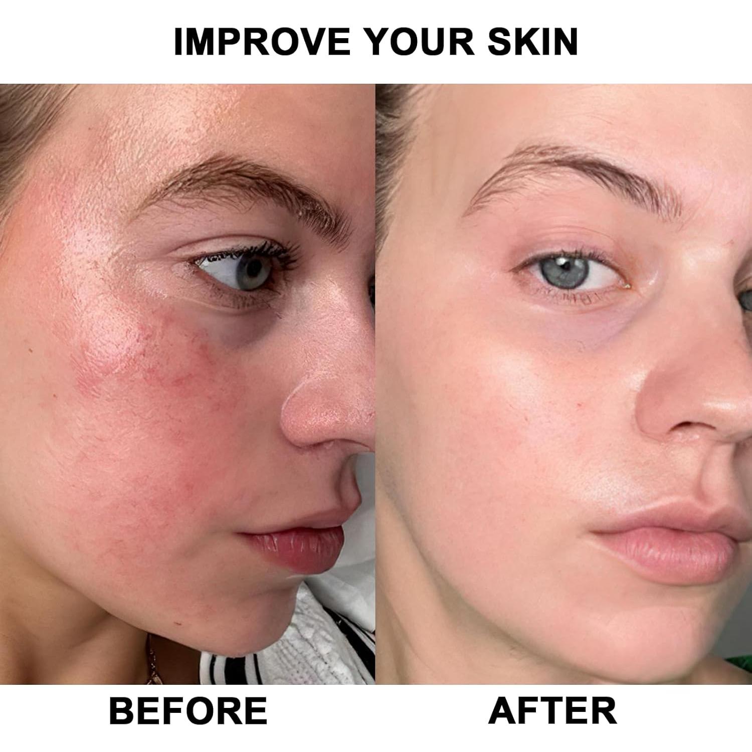 Panel de Luz Roja Terapéutica Anyork 660nm 55.88x29.97cm