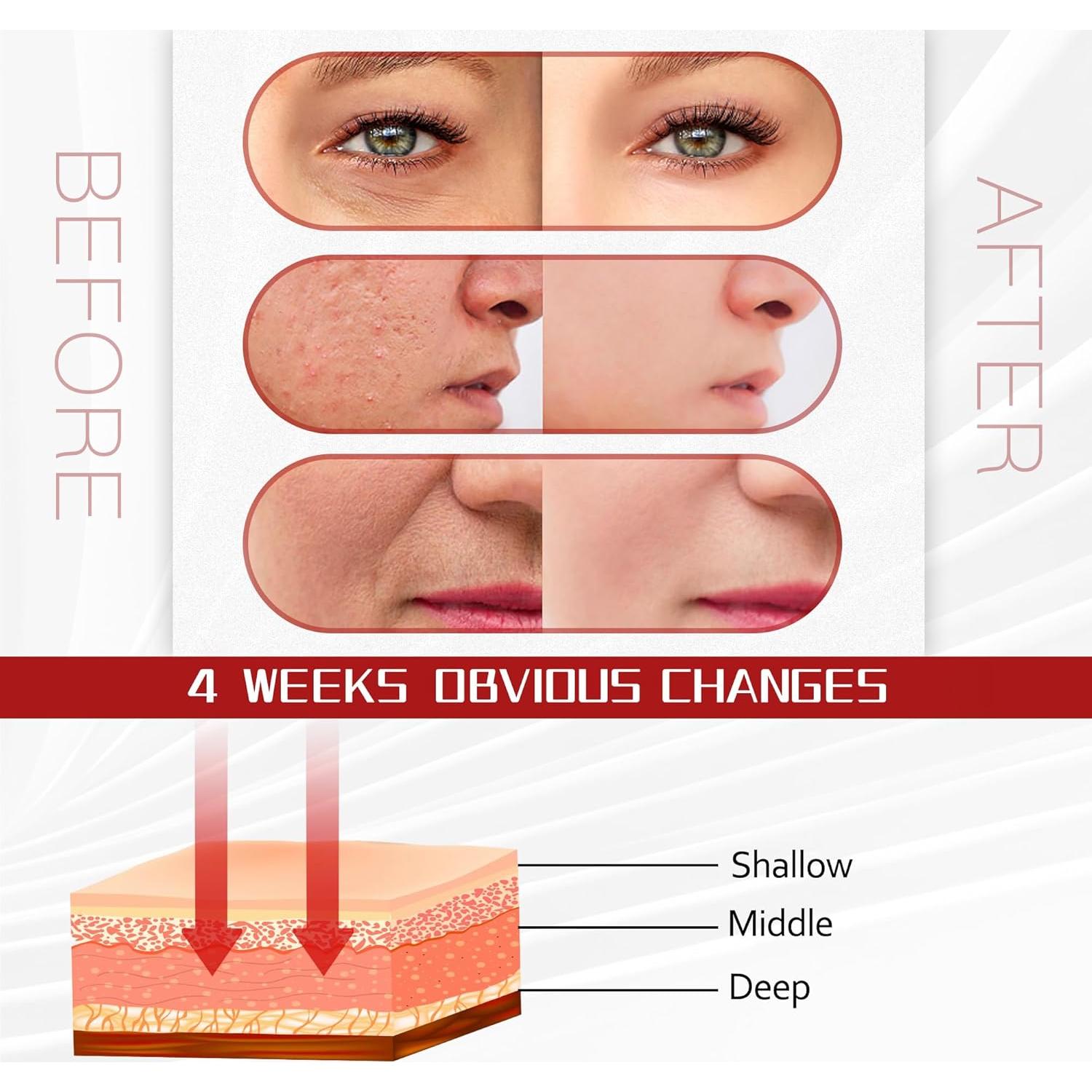 Máscara de Luz LED Facial SJFEHLLD 7 Colores Terapia