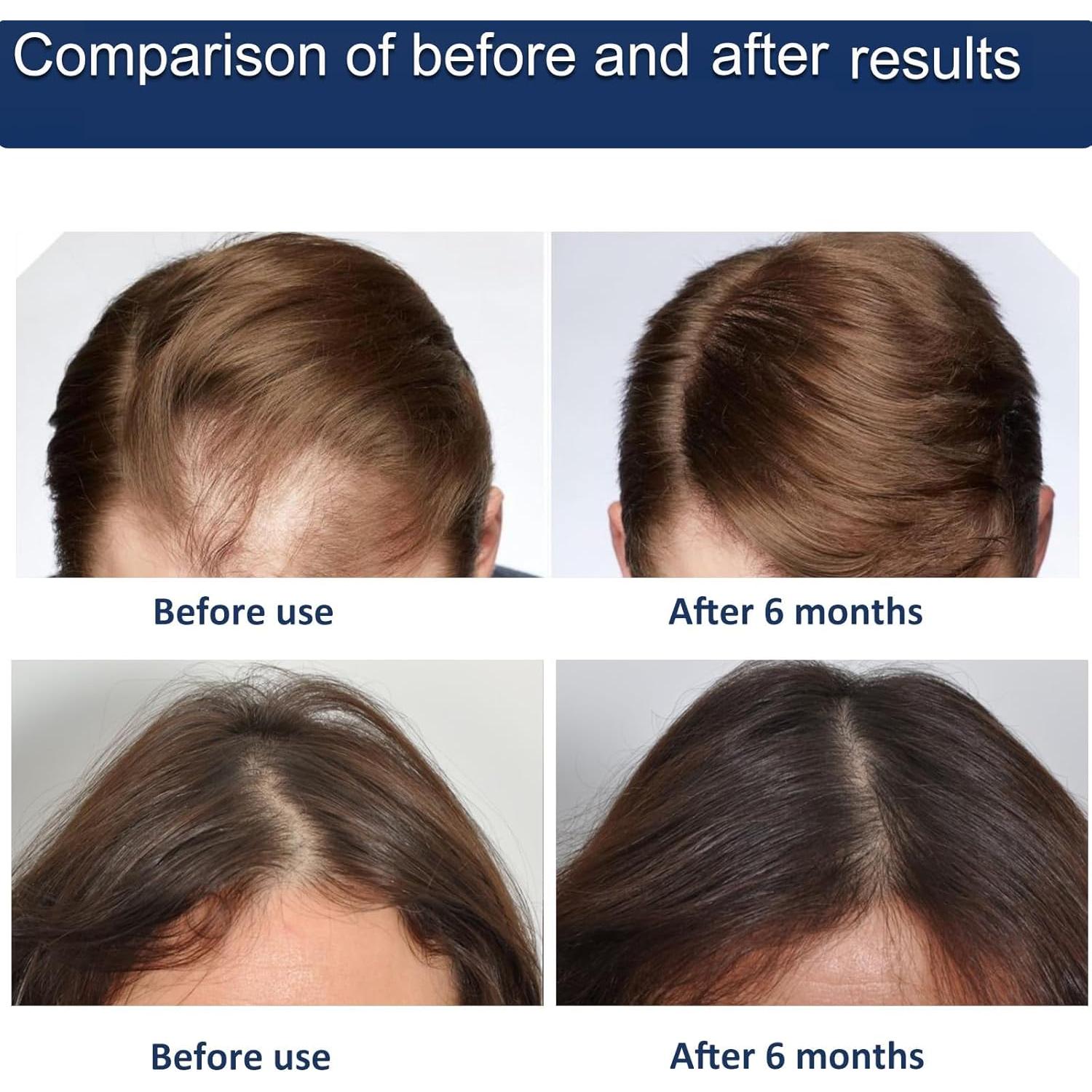 Dispositivo Terapia Luz Roja BJR - 3 Modos, Temporizador