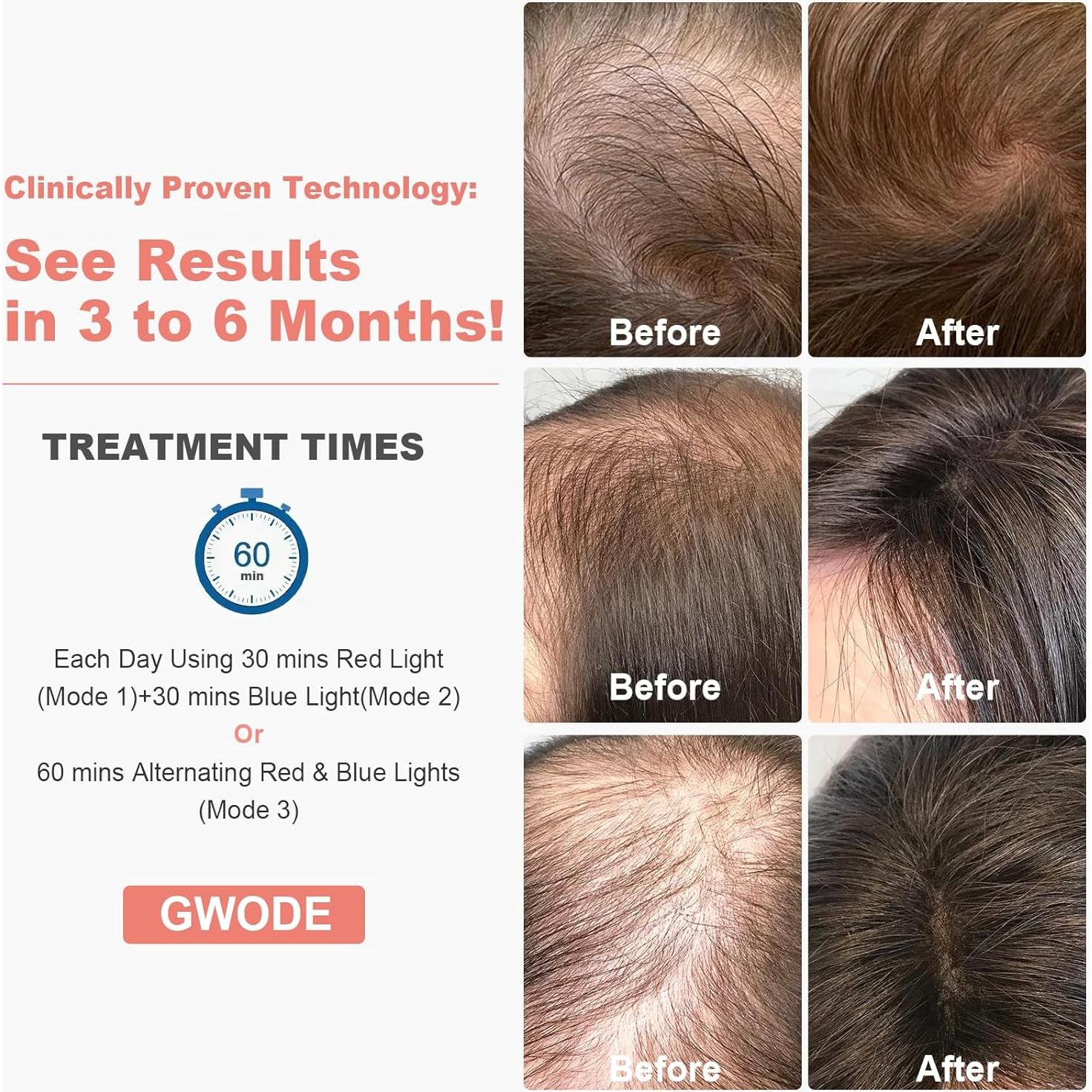 Dispositivo Terapia Luz Roja BJR - 3 Modos, Temporizador