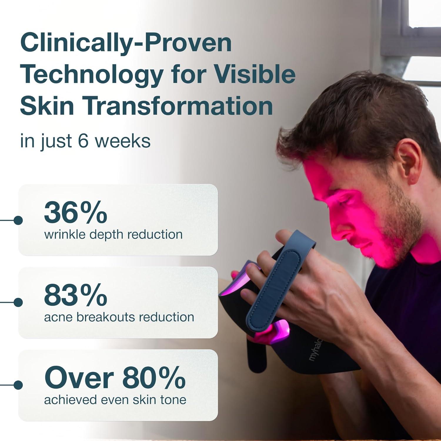 Máscara de Terapia de Luz Roja MyHalos para la Cara - LED Antienvejecimiento