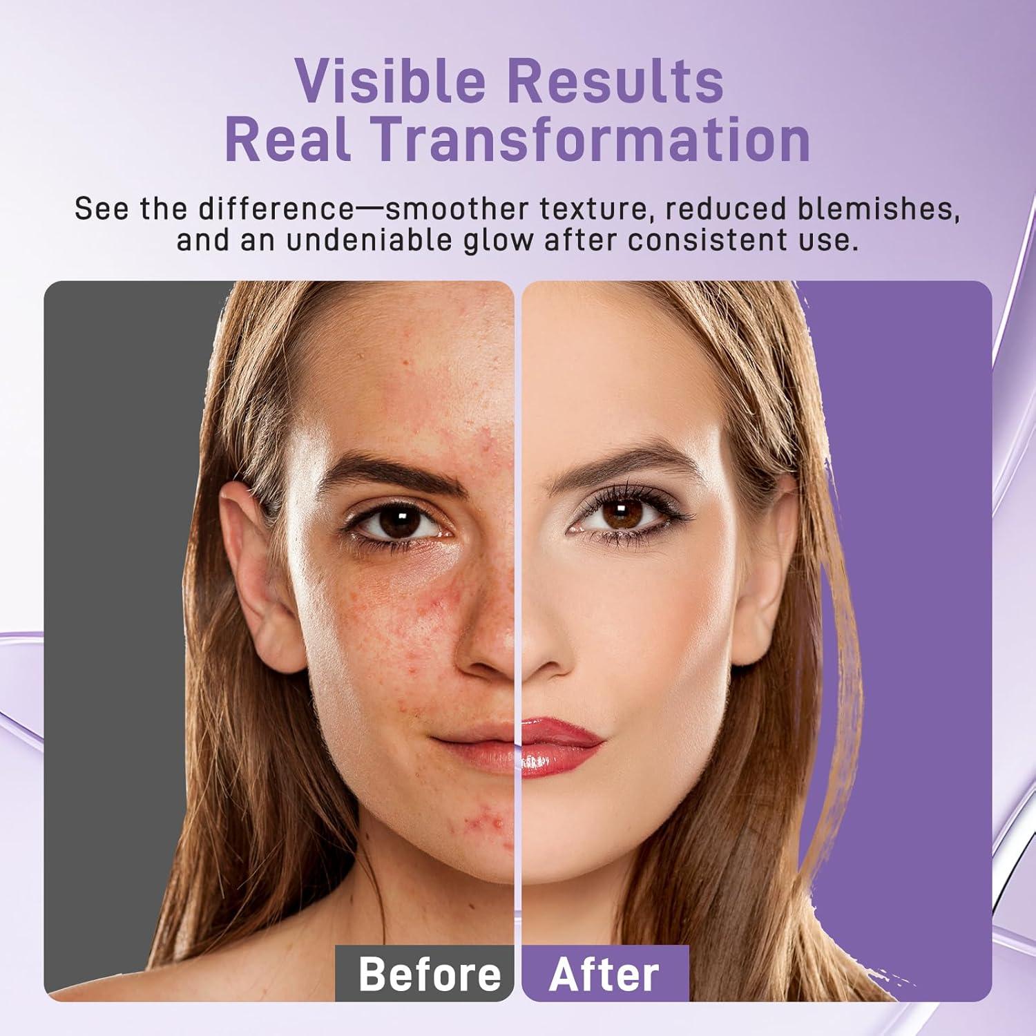 Máscara Facial LED Lovsheme - Terapia de Luz Roja para Piel