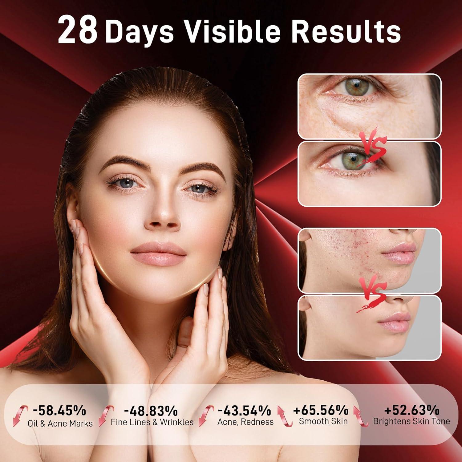 Red Light Therapy Mask for Face - 3 Light Modes, Ultra-Soft Comfort, Precise wavelength, Professional LED Face Mask Light Therapy for Skin Rejuvenation, Anti-Aging & Acne Treatment, Home Use