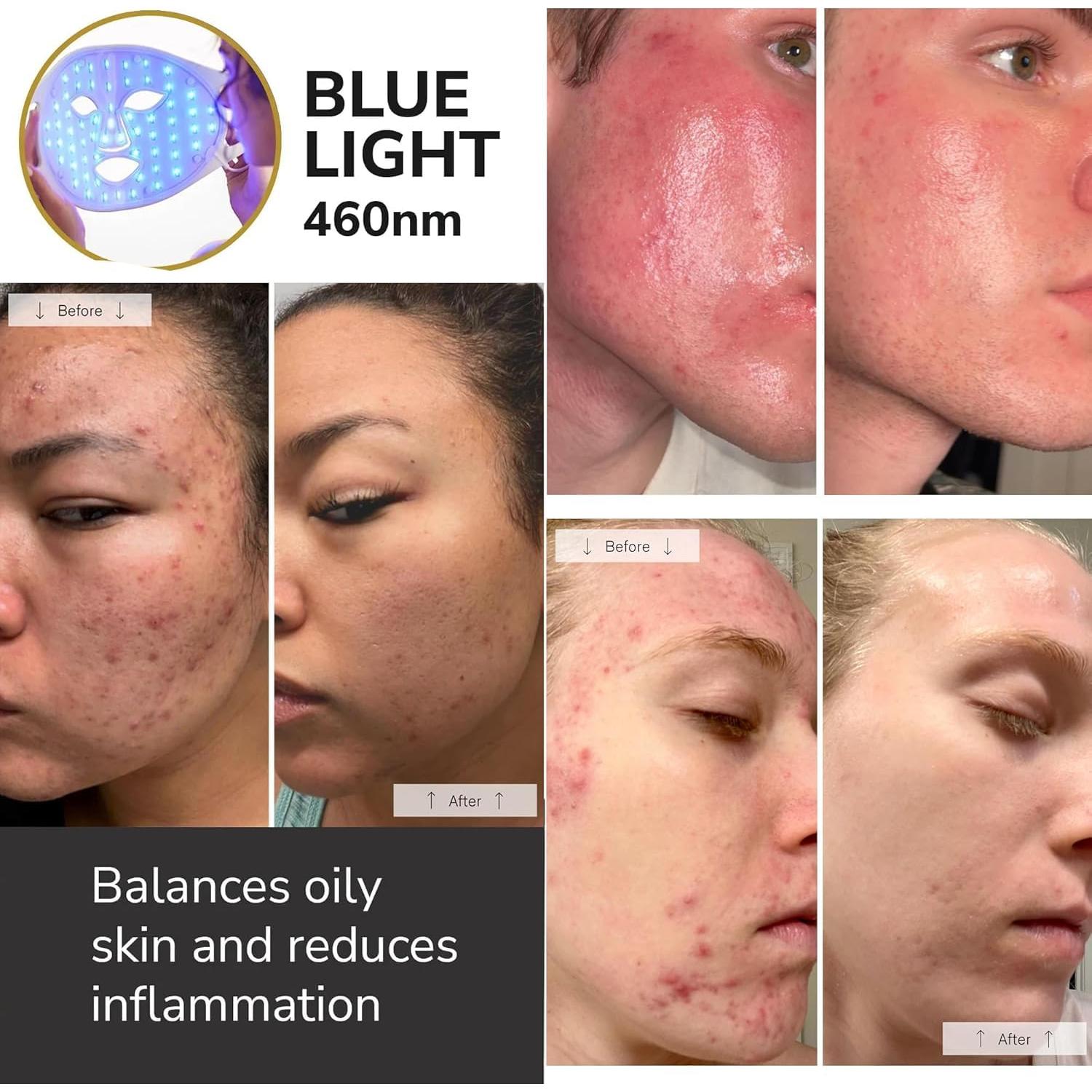 Red Light Therapy Mask Set, Led Mask Light Therapy for Face & Neck, Near-infrared Light 850nm and Red Light 630nm, 5 Gears Energy Adjustment