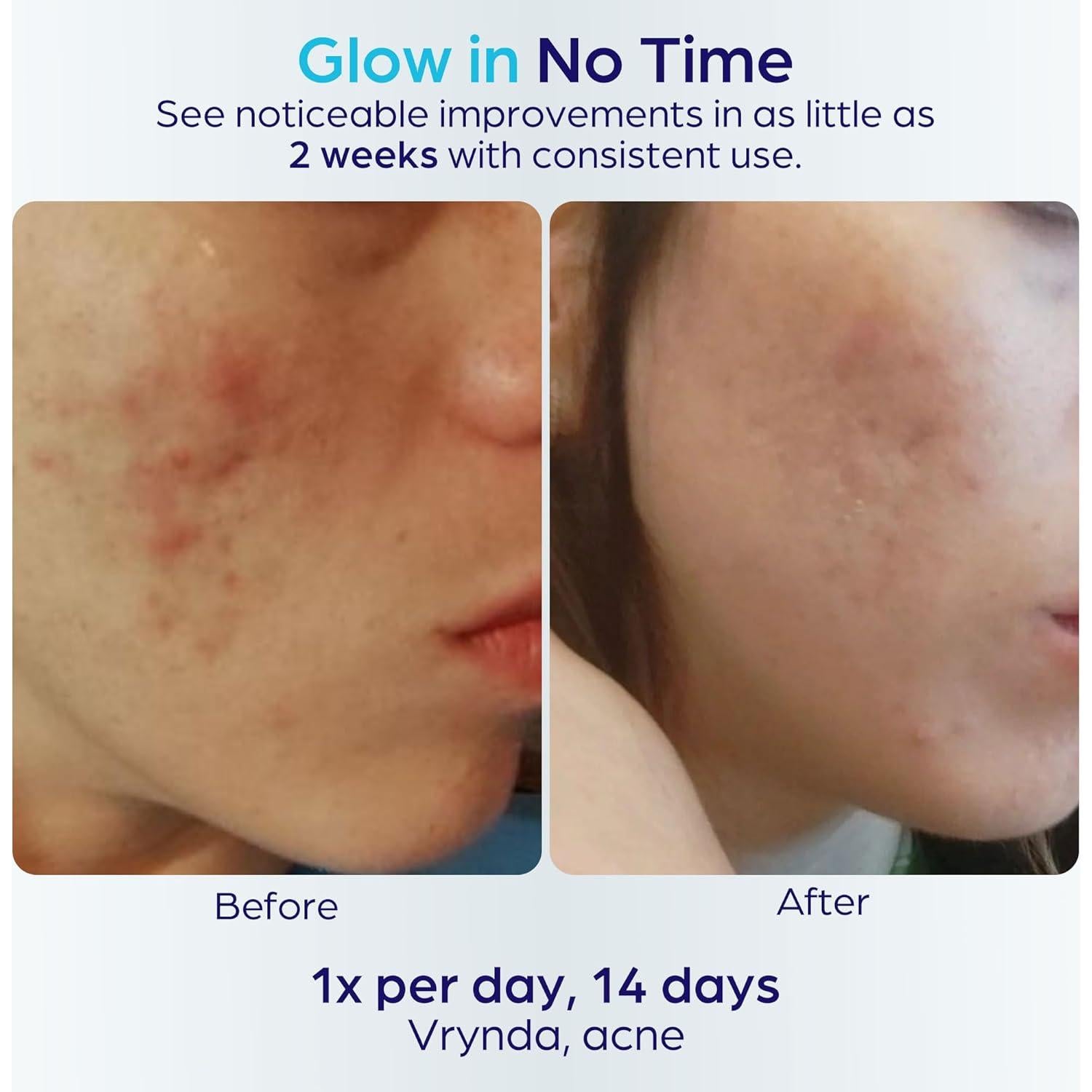 Máscara Facial LED Terapia de Luz Roja y Azul Ambicare PR7001US