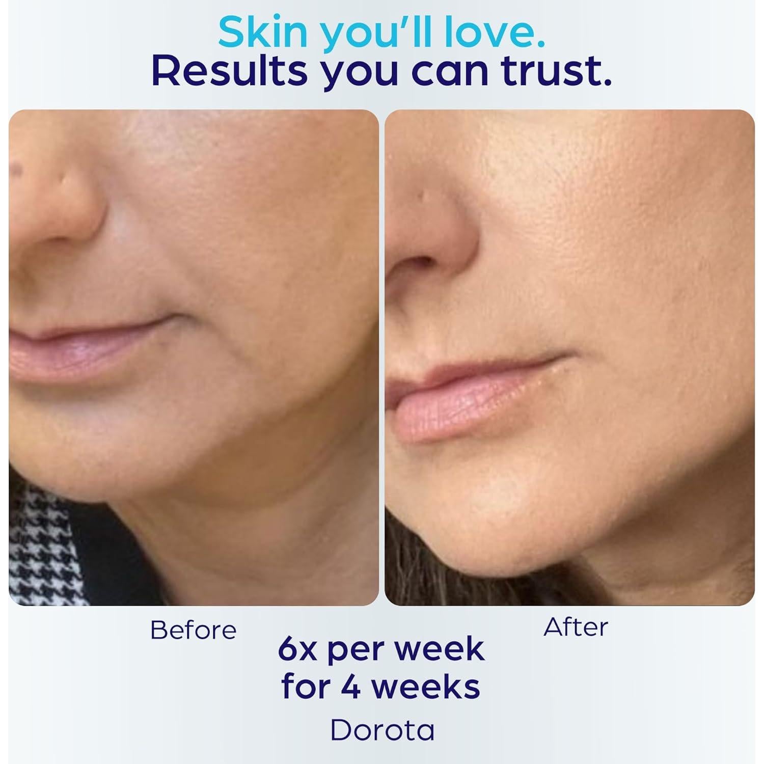 Máscara Facial LED Terapia de Luz Roja y Azul Ambicare PR7001US