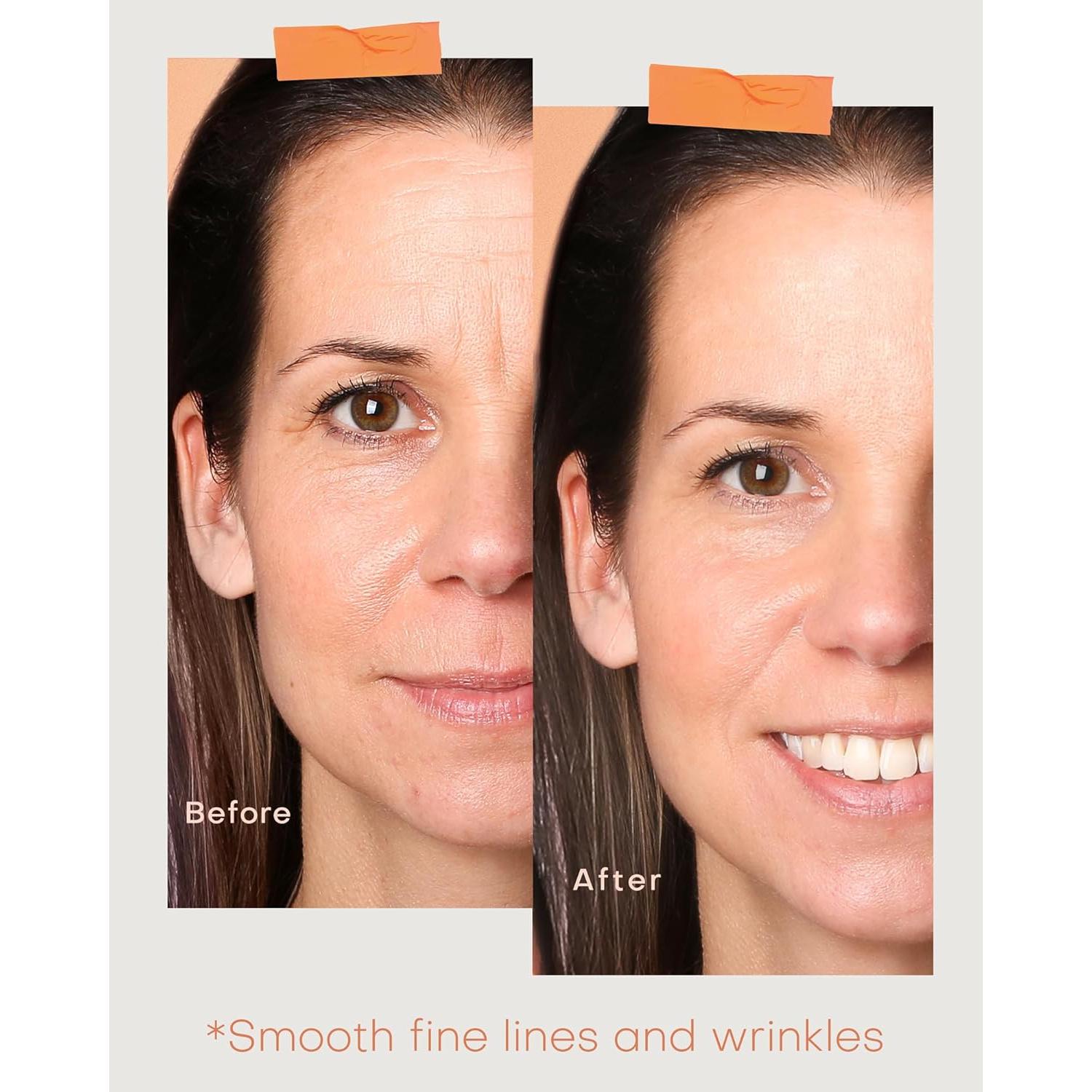 Máscara de Terapia de Luz Roja Inalámbrica NEWKEY MJ-06 10 Minutos