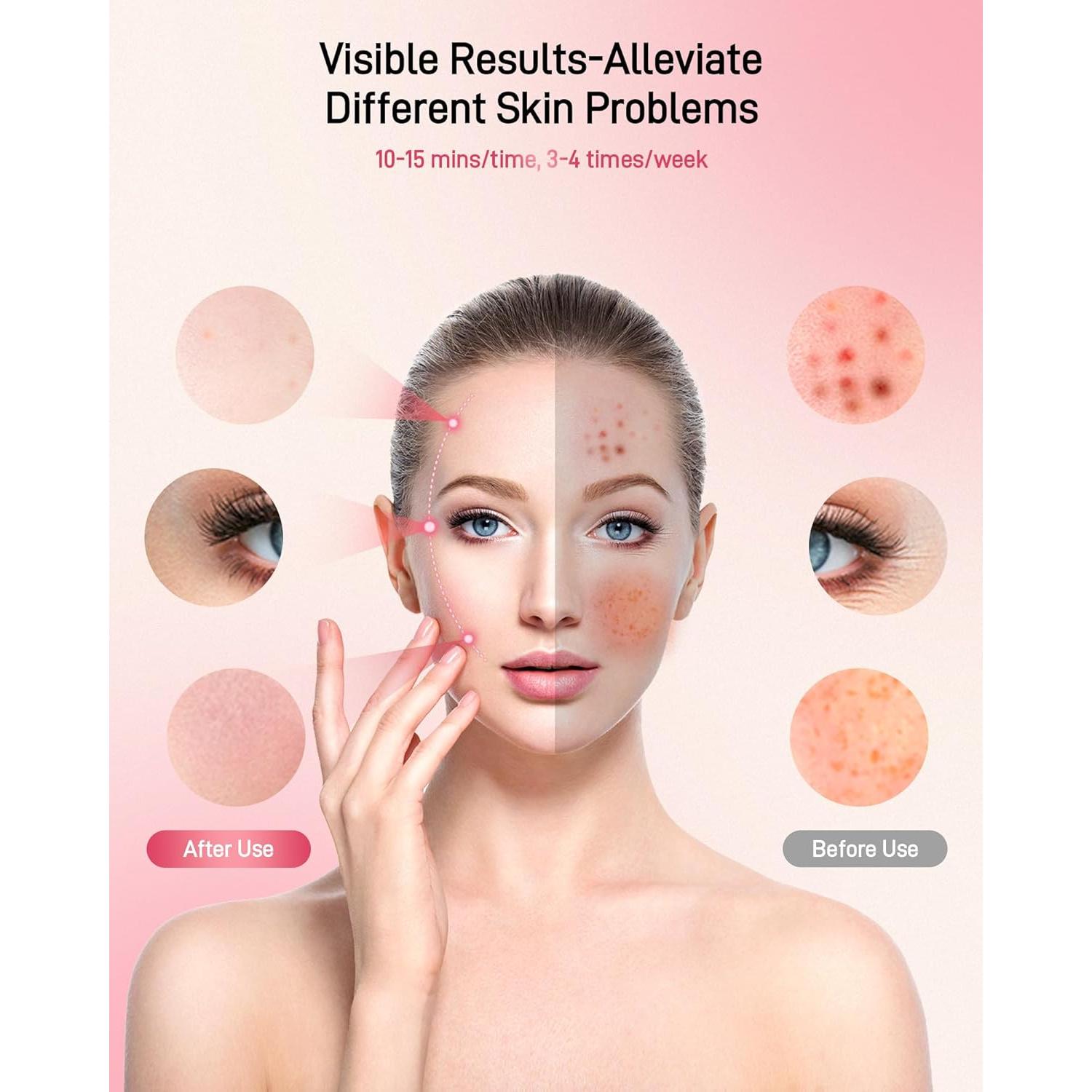 2025 New Red Light Therapy for Face, Glowing Wireless LED Face Mask Light Therapy with Advanced 4-Core LEDs, 2000mAh Remote, 660nm&850nm Near-Infrared Red Light therapy Mask for Home & Travel.