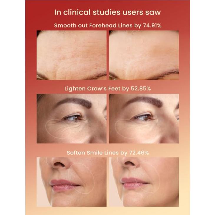 Máscara de Terapia de Luz Roja LAYNA para Arrugas y Piel Radiante