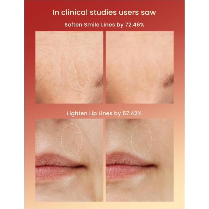 Máscara de Terapia de Luz Roja LAYNA para Arrugas y Piel Radiante