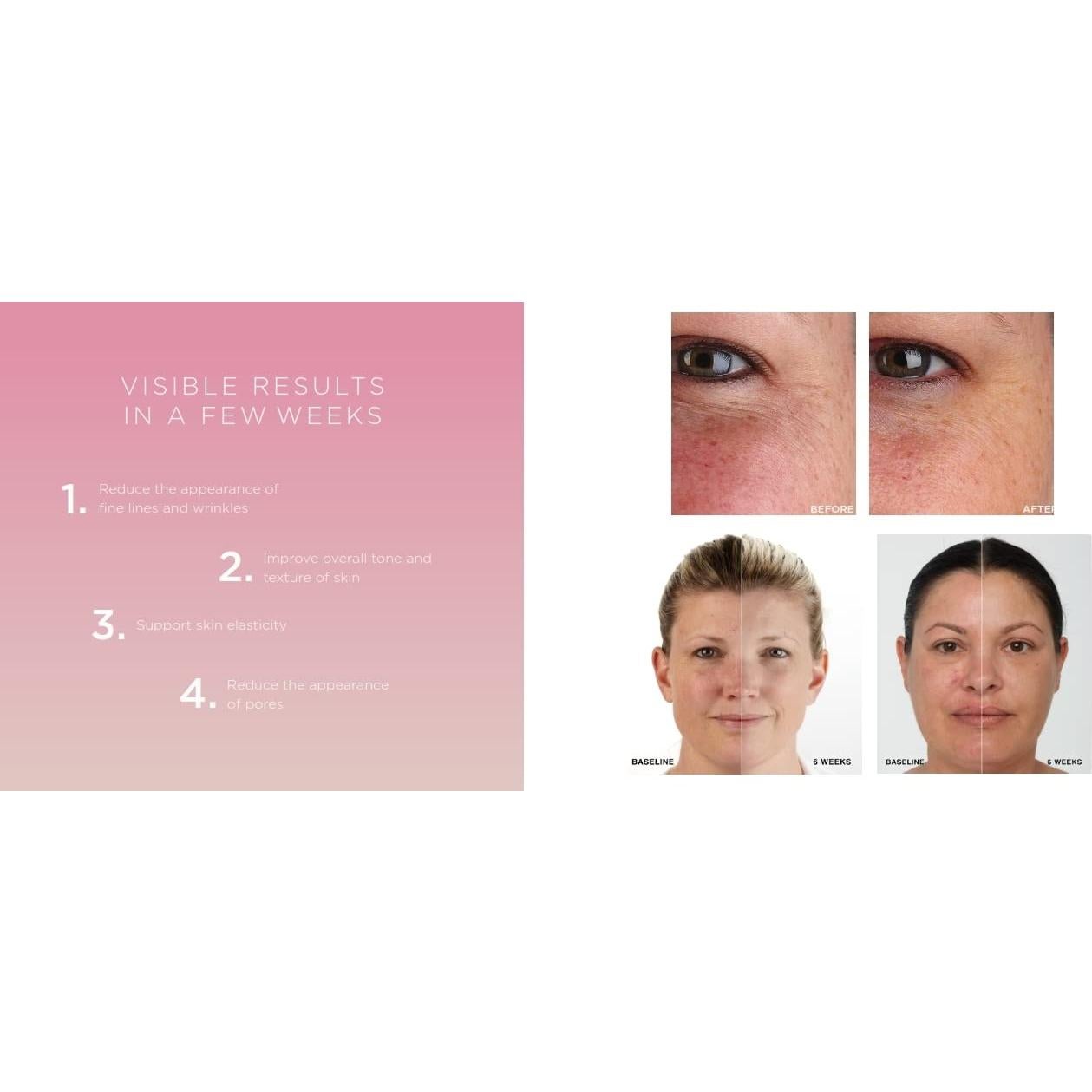 Máscara de Terapia de Luz Roja iDerma para Rejuvenecimiento Facial