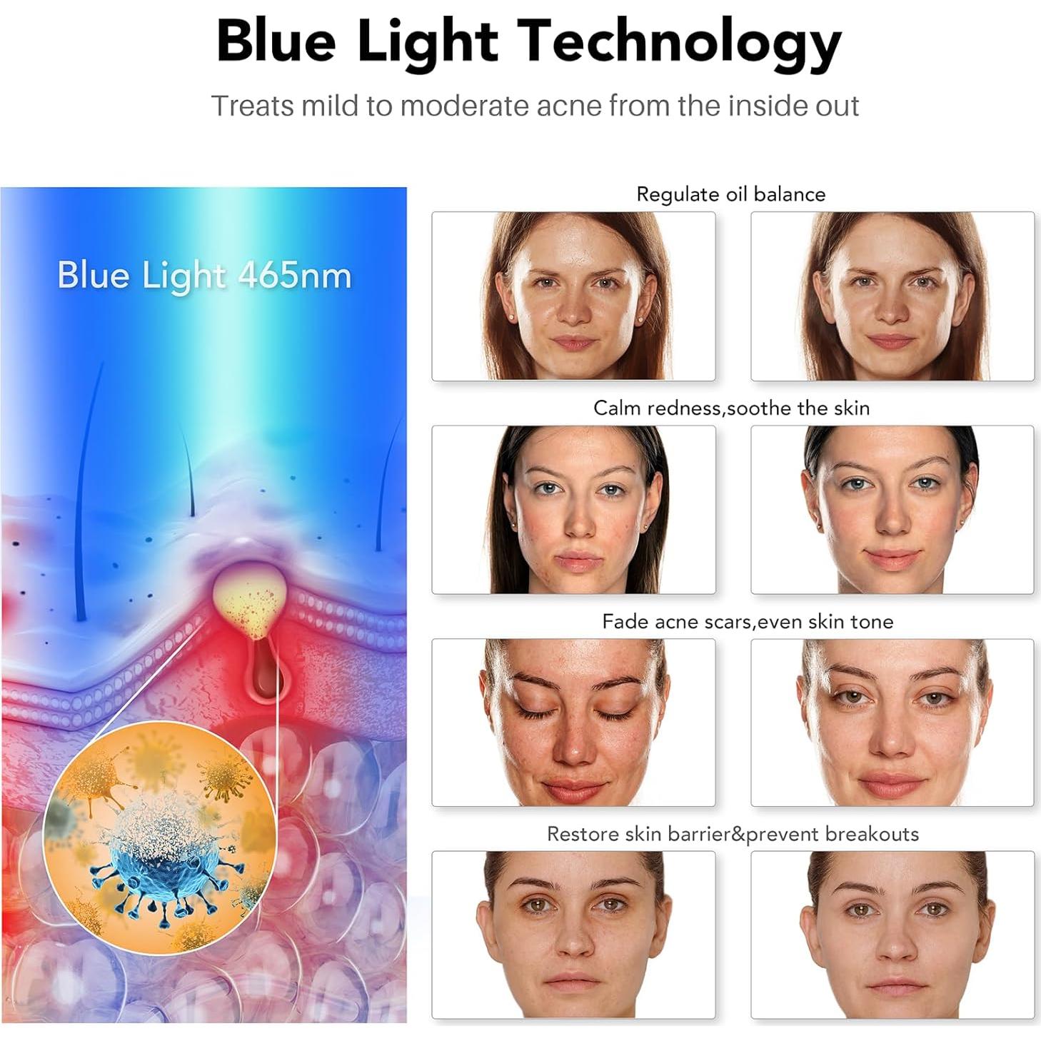Máscara LED de Terapia de Luz Azul NEWKEY para Acné Facial