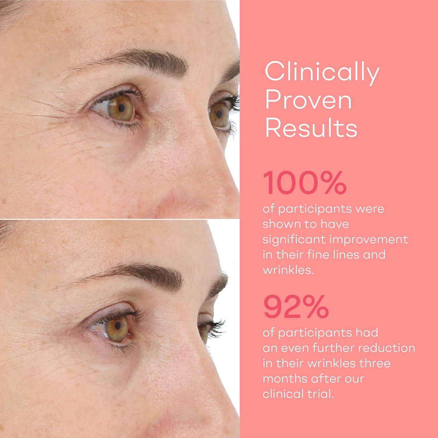 LightStim para Arrugas - Dispositivo Antienvejecimiento 22x7.6cm