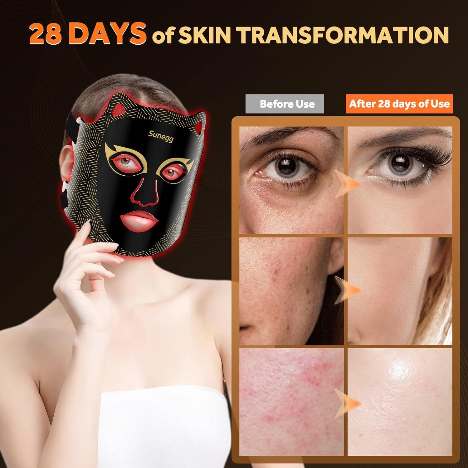 Máscara de Terapia de Luz LED Sunegg FM-01 para Cuidado Facial