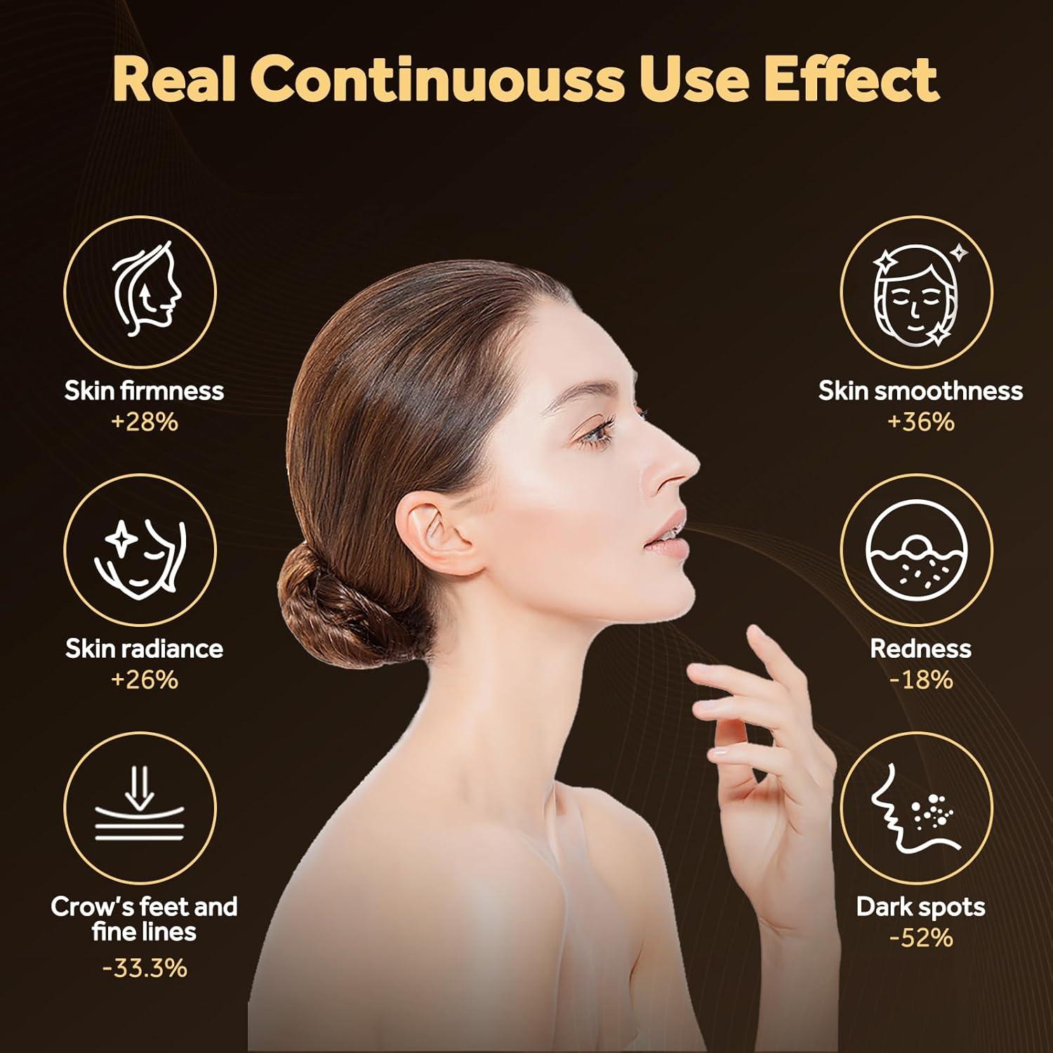 Máscara de Terapia de Luz LED Sunegg FM-01 para Cuidado Facial