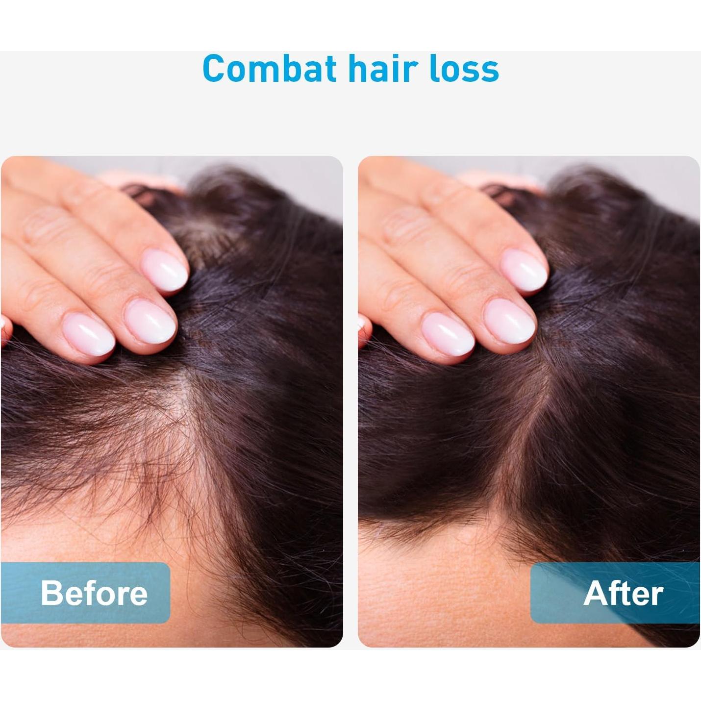 Cinturón de Terapia de Luz Roja Lzk para Pérdida de Peso