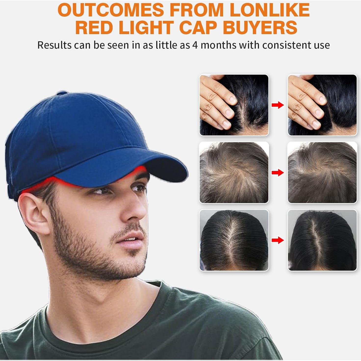 Gorro de Terapia de Luz Roja LONLIKE 630nm 850nm 940nm