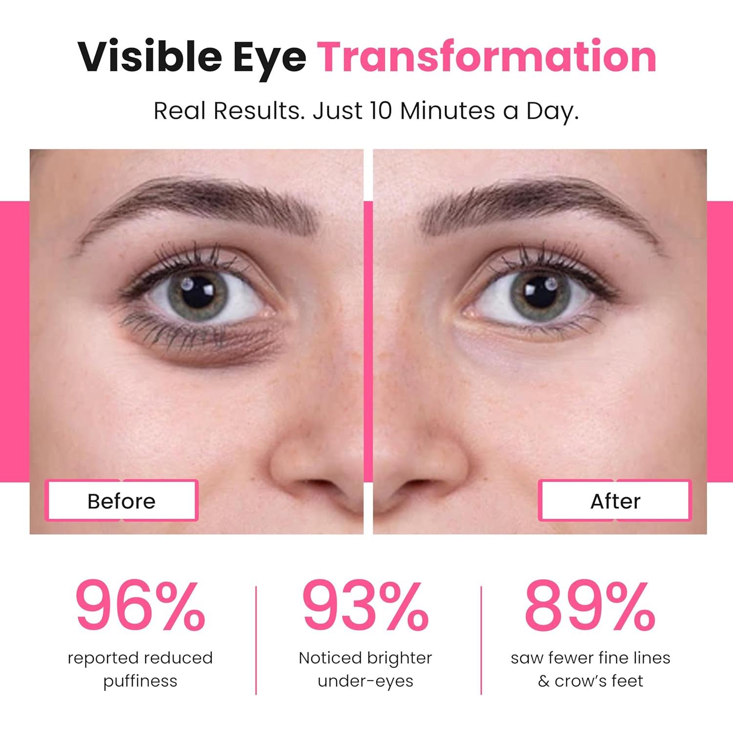 Revitaliza Ojos - Terapia de Luz Roja para Ojeras y Arrugas