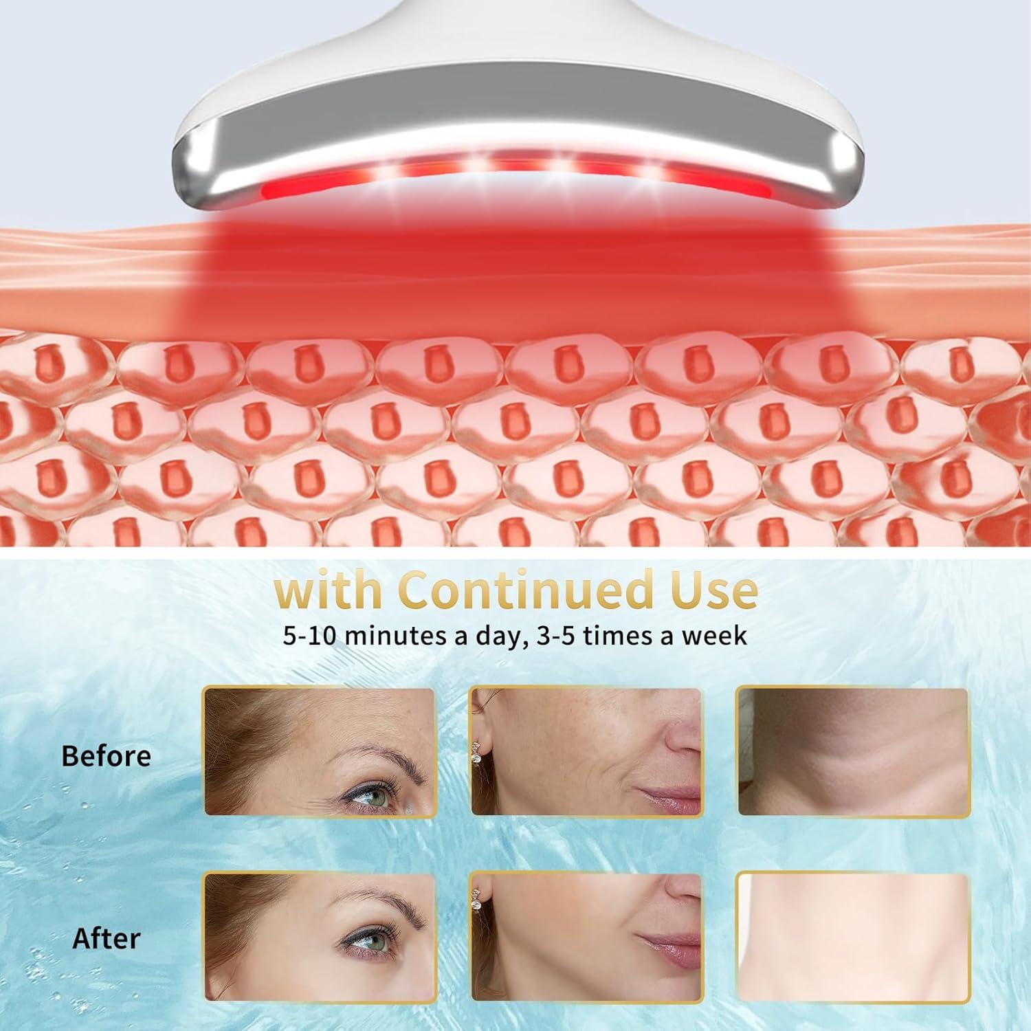 Masajeador Facial Li-Tek T-TPML-100 Luz Roja y Azul