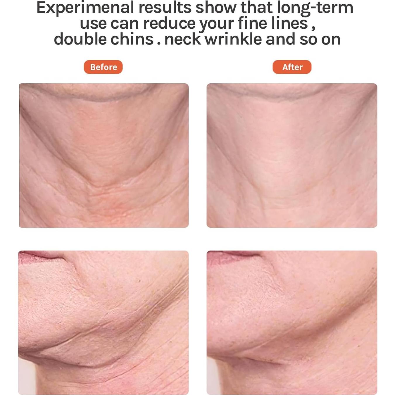 Masajeador Facial Ms.W Luz Roja y Vibración para Piel