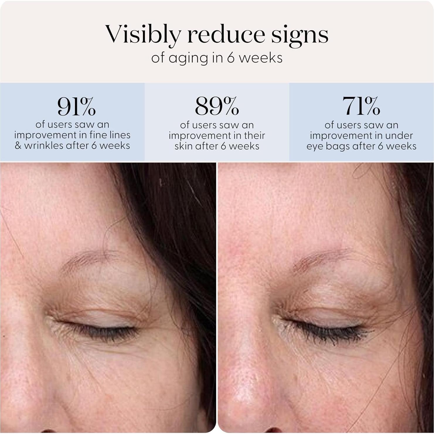 Dispositivo Terapia Luz Roja SmoothSkin para Ojos 24 Parches