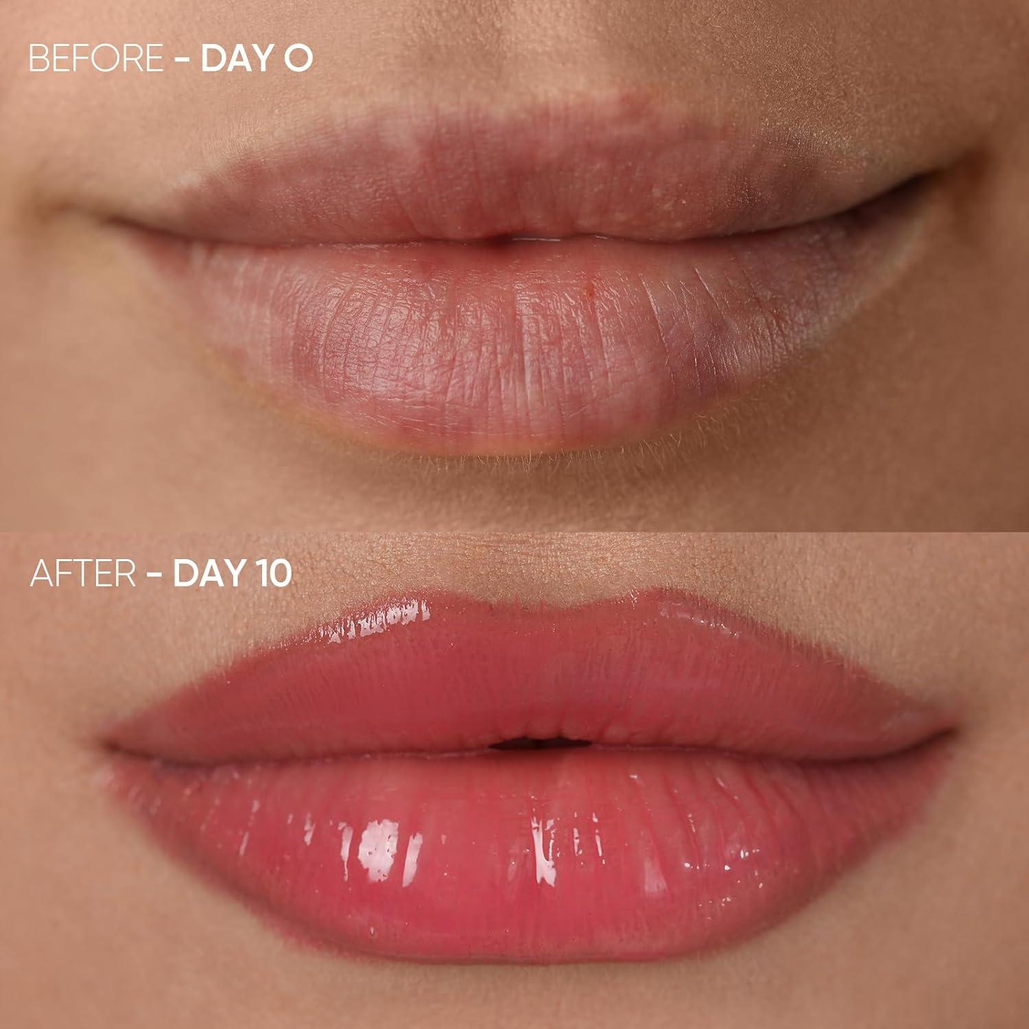 Dispositivo de Aumento de Labios LED Estanana - Terapia Luz Roja