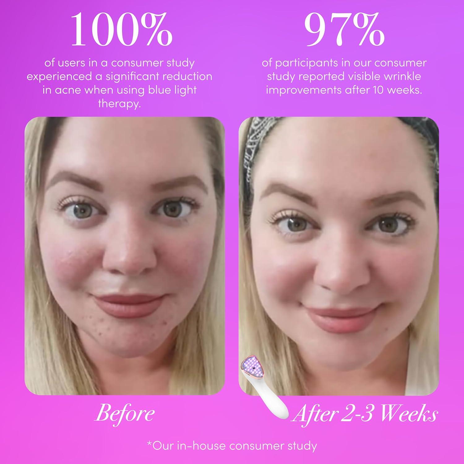 reVive Terapia de Luz Lux Clínica Antienvejecimiento y Acné