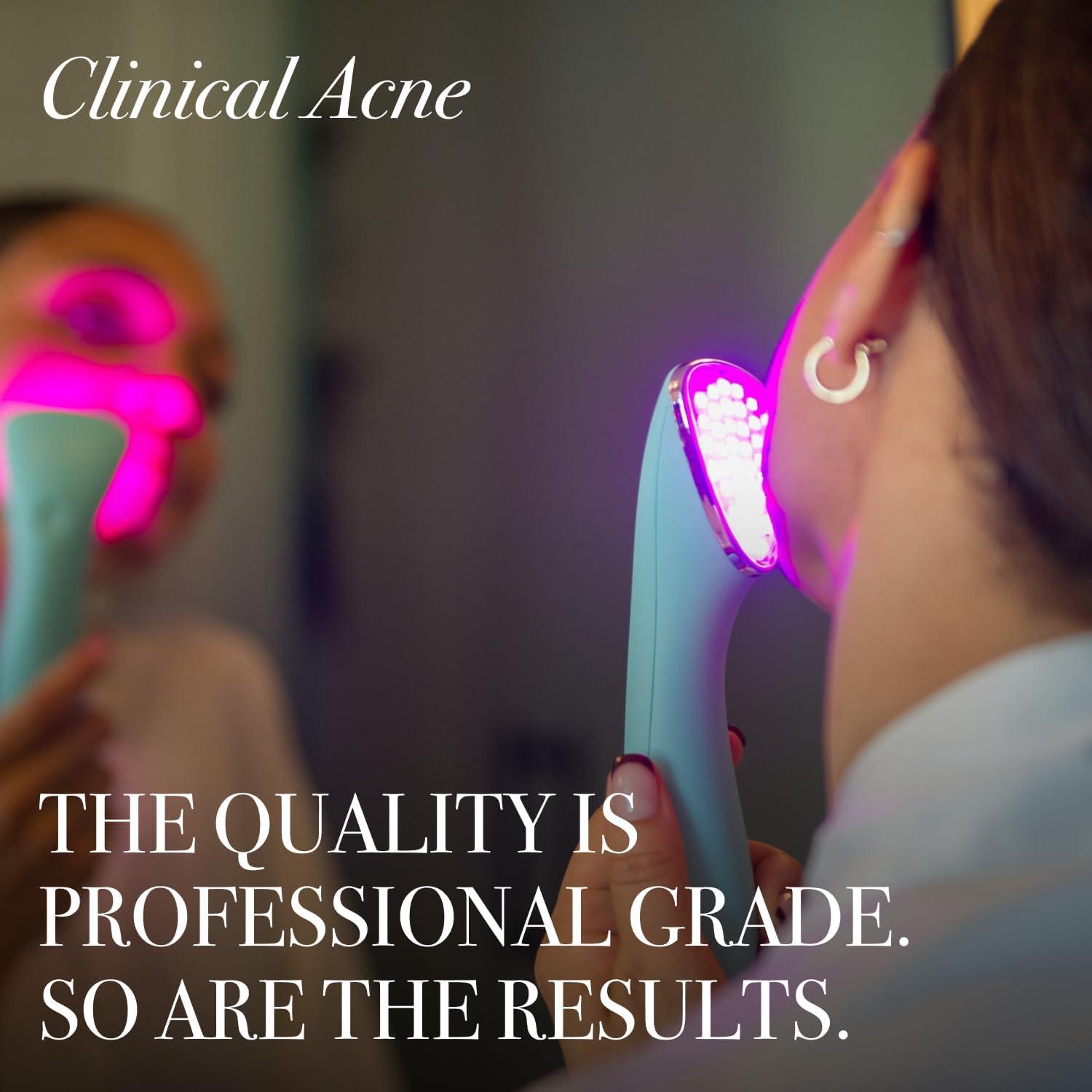 reVive Terapia de Luz Azul para Acné Facial - Dispositivo LED