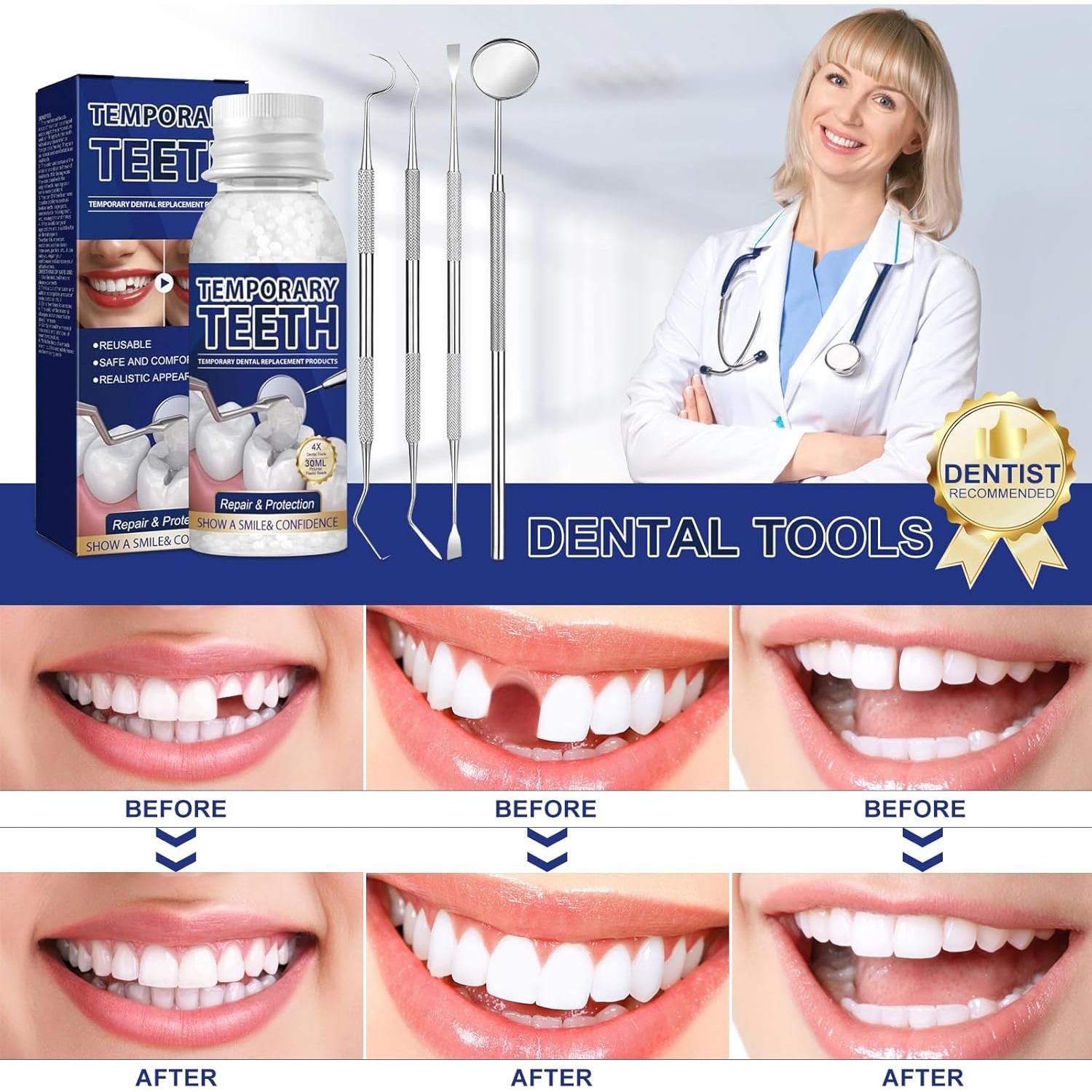Kit de Reparación Dental WALEJUC con 30ml y 4 Herramientas