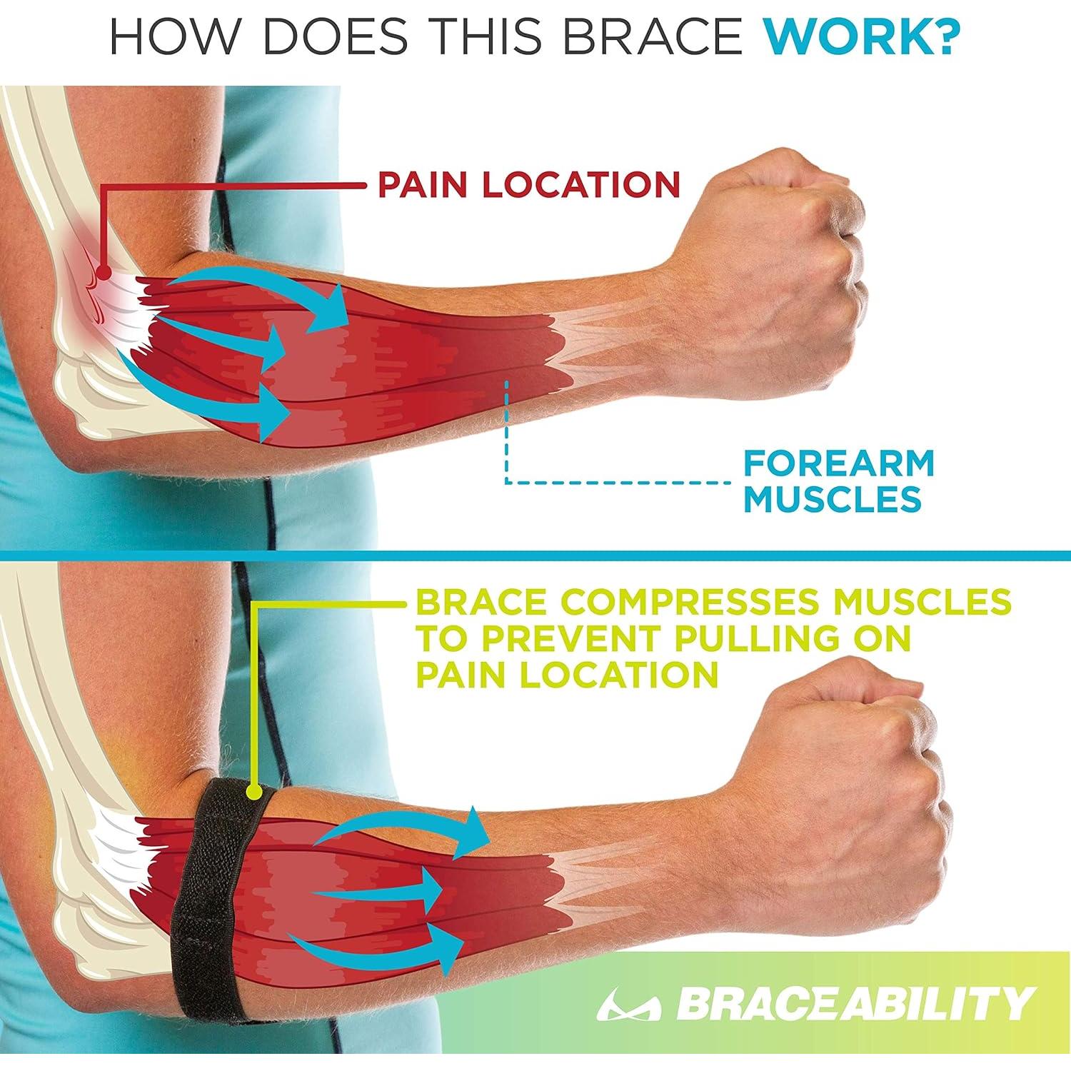 Faja para Epicondilitis BraceAbility - Soporte para Codo Unisex